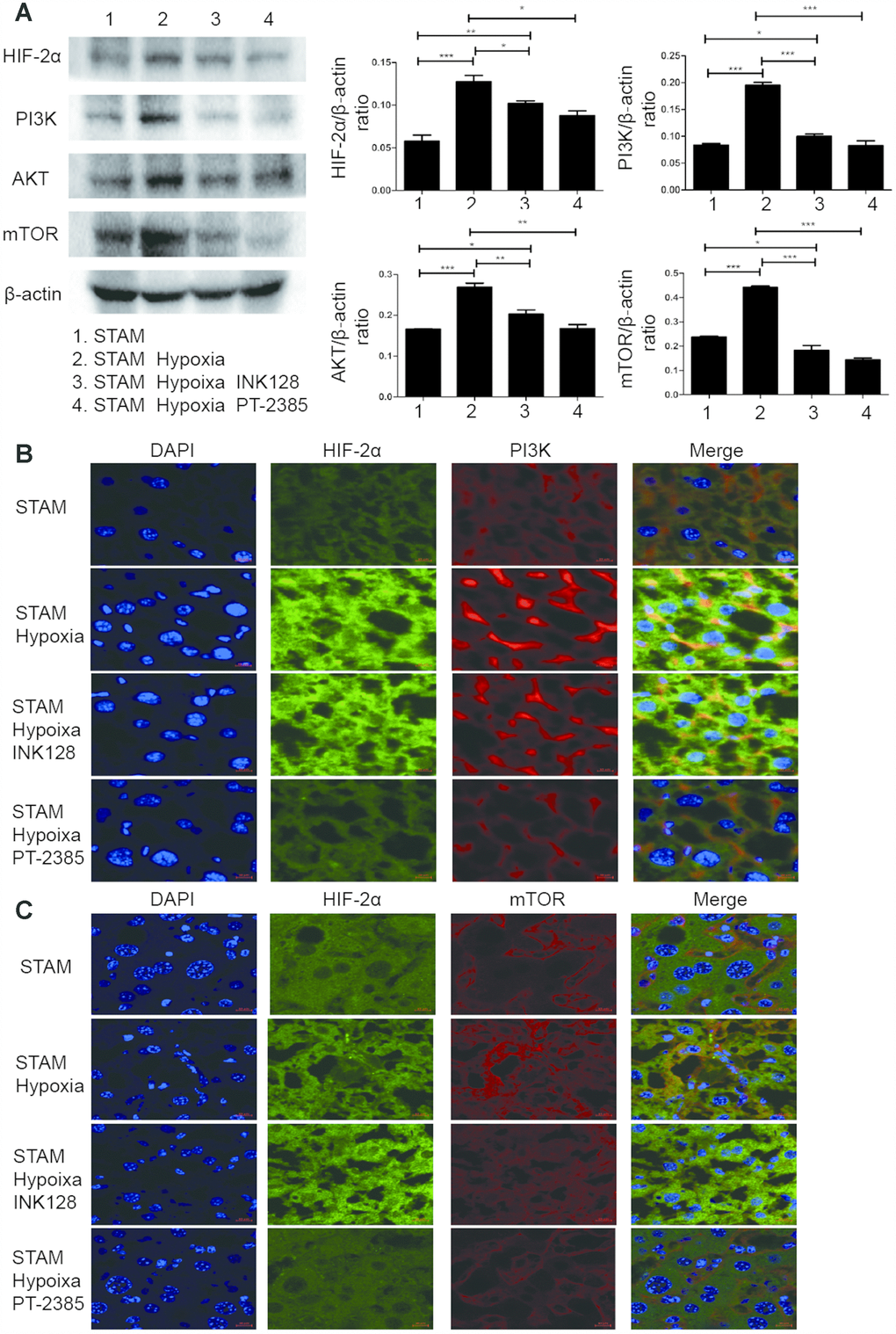 Hypoxia-induced HIF-2α overexpression promotes STAM mouse tumour development via activating the PI3K-AKT-mTOR signalling axis. (A) Western blot analysis of HIF-2α expression and expression of PI3K-mTOR pathway factors in STAM mice of different groups. β-Actin was used as the loading control. Densitometric analyses of the band intensity ratios for HIF-2α/β-actin, PI3K/β-actin and mTOR/β-actin. (B, C) The liver sections were stained with DAPI to visualise nuclei (blue), Alexa Fluor 488 to visualise the distribution of HIF-2α (green) and Alexa Fluor 568 to PI3K/mTOR (red) proteins. Scale bar: 10 μm.