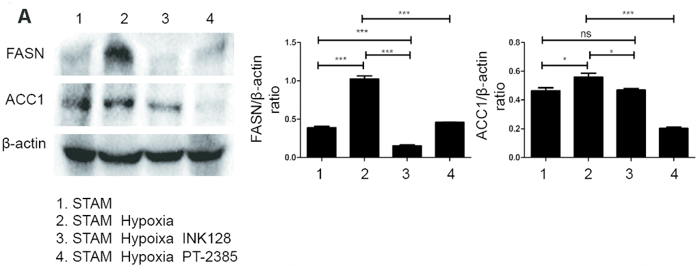 HIF-2α induced lipid synthesis and exacerbated lipid accumulation in STAM mice in vivo. (A), Western blot analysis of FASN and ACC1 expression in STAM mice of different groups. β-actin was used as the loading control. Densitometric analyses of the band intensity ratios for FASN/β-actin and ACC1/β-actin.