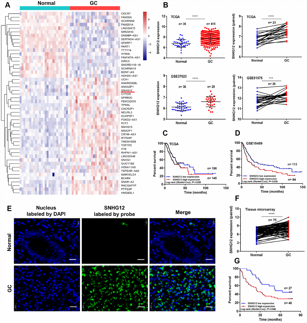 SNHG12 is upregulated in human GC and is associated with a poor prognosis. (A) Hierarchical heat map of differentially expressed genes between GC and para-cancerous tissues from the Gene Expression Omnibus database. Blue denotes downregulated genes and red denotes upregulated genes. (B) SNHG12 levels were detected in unpaired and paired GC tissues from TCGA, GSE37023 and GSE51575 cohorts. (C, D) Kaplan-Meier analysis of the association between SNHG12 expression and overall survival in GC patients, based on TCGA and GSE15459 cohorts. (E, F) FISH analysis of the subcellular localization and expression of SNHG12 in GC and para-cancerous tissues. The nucleus was labeled with DAPI (blue) and SNHG12 was labeled with a probe (green). Scale bar: 20 μm. (G) Kaplan-Meier analysis of the association between SNHG12 expression and overall survival in GC patients, based on the tissue microarray. ***P