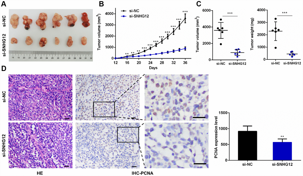 Knocking down SNHG12 inhibits xenograft tumor growth. (A) Representative images of xenograft tumors from the si-NC and si-SNHG12 groups. (B) The tumor growth curves of the si-NC and si-SNHG12 groups. (C) The tumor volumes and tumor weights of the si-NC and si-SNHG12 groups. (D) Representative images of hematoxylin and eosin staining and PCNA immunostaining of xenograft tumor samples from the si-NC and si-SNHG12 groups (scale bar = 200 μm), and semi-quantitative results of PCNA immunostaining. Data are shown as the mean ± SEM of at least six experiments. **PP