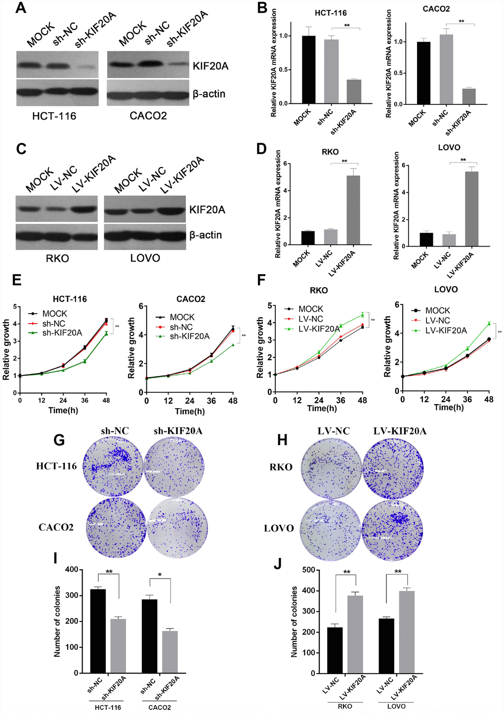 KIF20A improves malignant behaviors in CRC. (A and B) Western blot and RT-qPCR analysis of KIF20A in constructed cell lines. Mock represents blank groups. Sh-NC represents lentivirus-mediated control groups. Sh-KIF20A represents lentivirus-mediated KIF20A silencing groups. (C and D) Western blot and RT-qPCR analysis of KIF20A in constructed cell lines. Mock represents blank groups. Lv-NC represents lentivirus-mediated control groups. Lv-KIF20A represents lentivirus-mediated KIF20A overexpression groups. (E) The relative growth rates in KIF20A knockdown CRCs were measured using CCK-8 analysis and compared between 3 groups at indicated times in two different cell lines. Data are presented as mean ± SEM. *P P F) The relative growth rates in KIF20A overexpression CRCs were measured using CCK-8 analysis and compared between three groups at indicated times in two different cell lines. Data are presented as mean ± SEM. *P P G–J) Colony formation of 4 different cell lines transfected with different treatments. Data are presented as mean ± SEM. *P P 