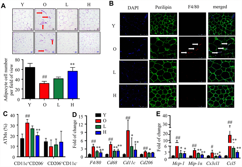 α-Man mitigates age-related adipose tissue inflammation. (A) H&E staining of eWAT (black scale bar = 50 μm, blue scale bar = 100 μm). (B) Whole-mount immunohistochemistry analysis of the nuclei (blue), perilipin (green), and F4/80 (red), scale bar = 75 μm. The CLSs are indicated by arrows (C) ATM subtypes were quantified as a percentage of the total ATMs population using flow cytometry. (D) qRT-PCR analyses for macrophage markers in eWAT, including F4/80, Cd68, Cd11c, and Cd206. (E) qRT-PCR analyses for chemokines in eWAT, including MCP-1, MIP-1α, Cx3cl1, and Ccl5. Data are normalized to the mean value of old group. Data are expressed as means ± SD (n = 5). #P ##P P P 