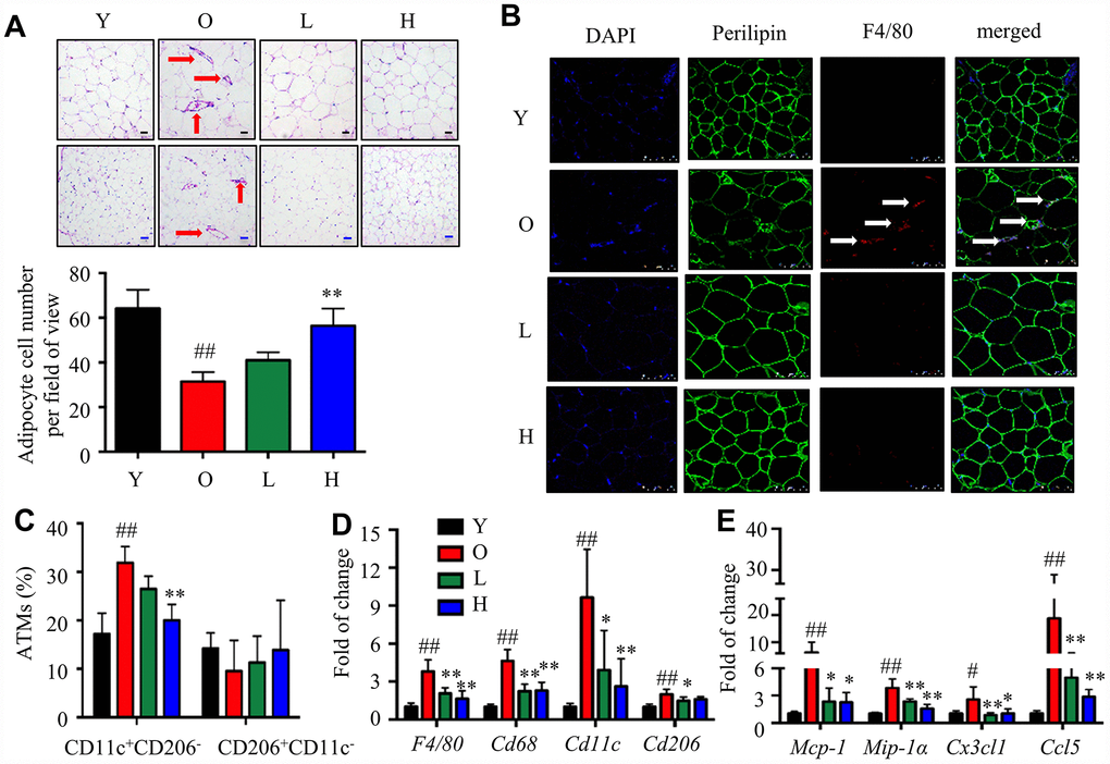 α-Man mitigates age-related adipose tissue inflammation through NF-κB and MAPKs pathways. (A) Relative mRNA levels of iNos, Il-1β and Tnf-α in eWAT were analyzed by qRT-PCR. (B) The protein levels of iNOS, COX-2 and SIRT3 in eWAT were detected by Western blot analyses and quantified using Image J. (C) The expression of p-IKKα/β, IKKα, IKKβ, p-IκBα, IκBα, p-p65 and p65 was detected by Western blot. (D) The expression of p-ERK, ERK, p-p38, p38, p-JNK and JNK were detected by Western blot. α-Tubulin was used as an internal control. Data are normalized to the mean value of old group. Data are expressed as means ± SD (n = 5). #P ##P *P **P 