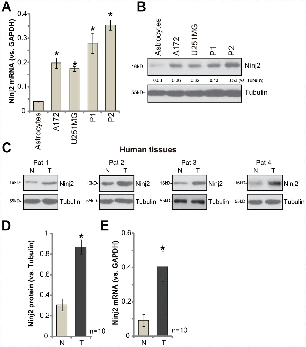 Ninj2 is upregulated in human glioma cells and tissues.Ninj2 mRNA and protein levels in established (A172 and U251MG) and primary human (“P1/P2”) glioma cells as well as in the primary human astrocytes (“Astrocytes”) were tested by qPCR (A) and Western blotting (B), respectively. A total of ten (10) pairs of human glioma tissues (“T”) and paired surrounding normal brain tissues (“N”) were homogenized and dissolved in tissue lysis buffer, Ninj2 mRNA and protein expression was tested (C–E). Data were presented as the mean ± SD (same for all Figures).*pA). *pD and E). Experiments in this figure were repeated four times, and similar results were obtained.