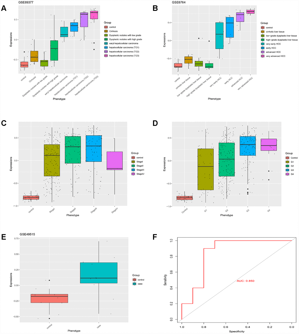 The HGSVA score increased significantly with the progression from cirrhosis to HCC. (A) The HGSVA score in GSE89377. (B) The HGSVA score in GSE6764. (C) The HGSVA score in the TCGA HCC data set (phenotype defined by pathological stage). (D) The HGSVA score in the TCGA HCC data set (phenotype defined by tissue grade). (E) The HGSVA score in GSE6764. (F) ROC results: the AUC is significant, which indicates that the gene set can be used for the early diagnosis of HCC.