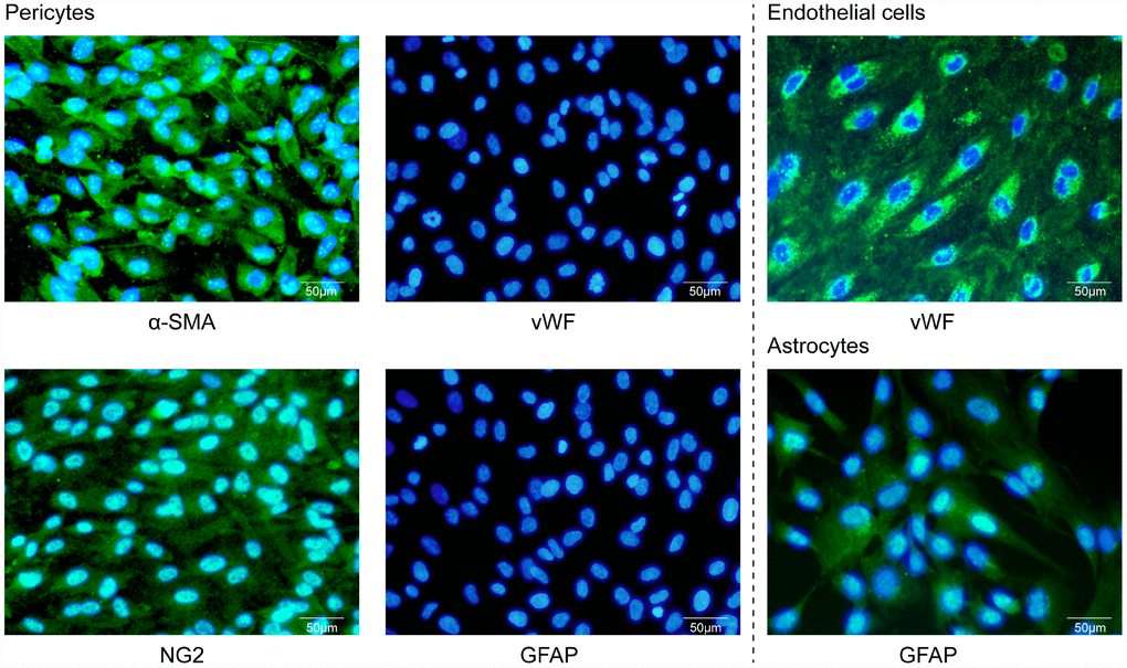 Characterization of primary cultures by immunofluorescence microscopy. Human brain microvascular pericytes showed positive immunostaining for α-SMA and NG2 but were negative for endothelial or astrocytic markers. Endothelial cells expressed the von Willebrand factor (vWF), while astrocytes were positive for GFAP. Scale bar = 50 μm.
