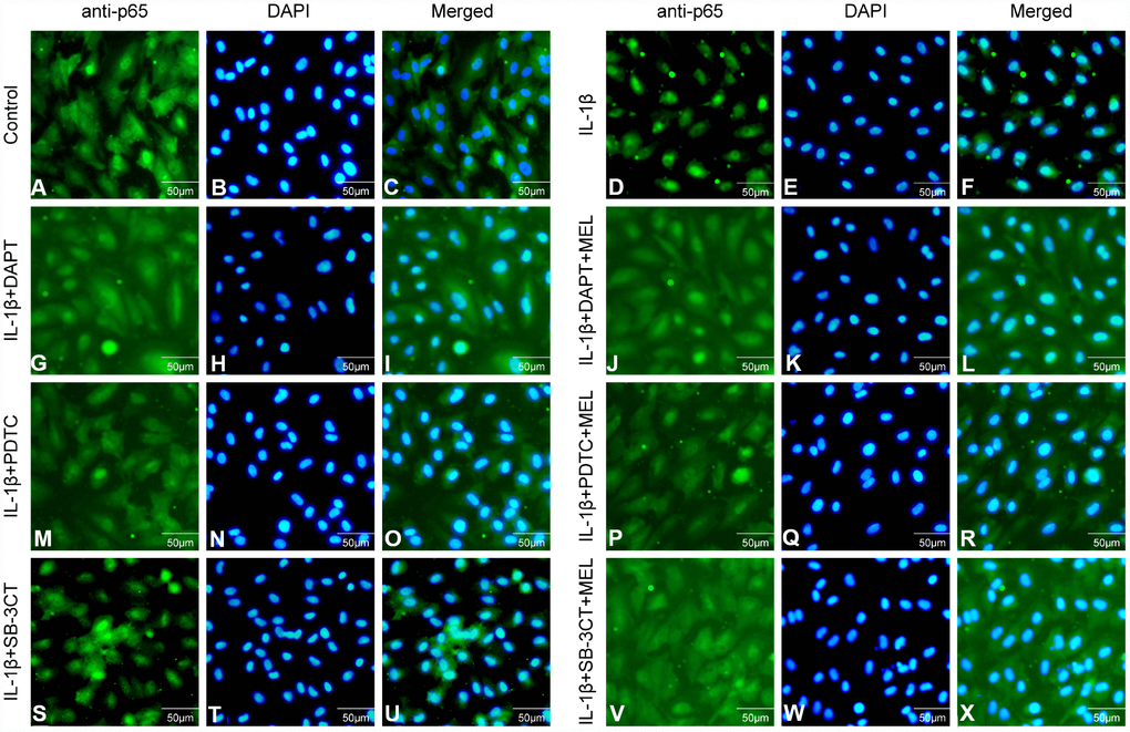 Effect of melatonin pretreatment on the expression and translocation of p65 in the different groups. Alexa Fluor 488 conjugated goat anti-p65 (A, D, G, J, M, P, S, V), DAPI (B, E, H, K, N, Q, T, W) and merged immunofluorescence (C, F, I, L, O, R, U, x) were observed under a fluorescence microscope.