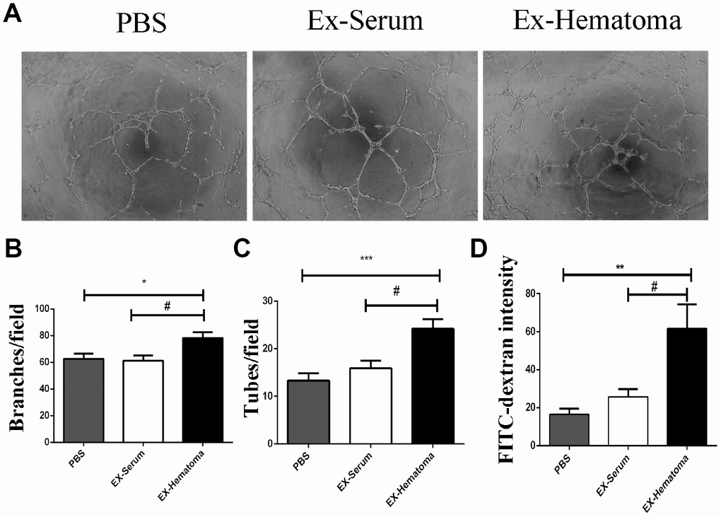 The effects of hematoma-derived exosomes on tube formation and vascular permeability in HUVECs. (A) Representative images of tube formation. (B, C) Quantification of branch and tube formation. (D) Permeability of HUVEC monolayers to FITC-Dextran. The FITC-Dextran intensity was higher in the EX-Hematoma compared to the EX-Serum group. * p 