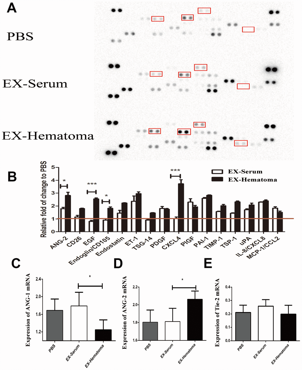 Hematoma Derived Exosomes Of Chronic Subdural Hematoma Promote Abnormal Angiogenesis And Inhibit