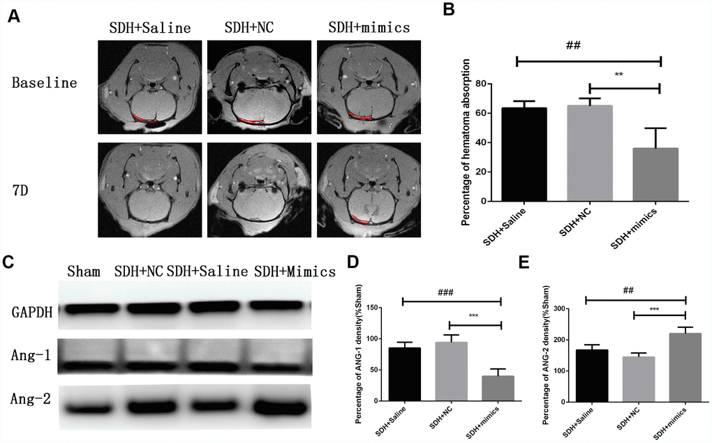 Over-expression of miR-144-5p results in decreased hematoma absorption, increased ANG-2 expression, and decreased ANG-1 expression in SDH rats. (A) Representative MR images of SDH rats at baseline and day 7. (B) Quantification of the percentage of hematoma absorption at baseline compared to day 7. Decreased hematoma absorption on day 7 was observed in the SDH + miRNA mimic group compared to the saline and negative control (NC) groups. (C) Representative images of western blots demonstrating differences in ANG-1 and ANG-2 expression. (D,E) Quantification of ANG-1 and ANG-2 expression. ** p 