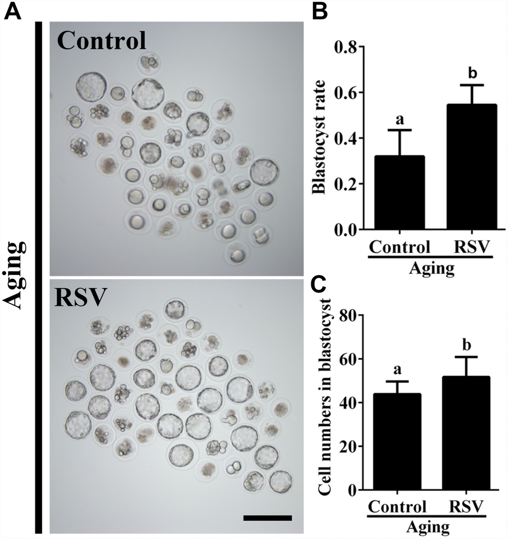 RSV promotes the developmental competence of aged oocytes. (A) Fresh oocytes were cultured in vitro with or without RSV for 8 h. These oocytes were parthenogenetic-activated and cultured for additional 3.5 days. Bar = 200 μm. (B) Statistical results of blastocyst rate in (A). (C) Quantitative analysis of blastocyst cell numbers in (A). Embryos were stained with DAPI. All experiments were performed in triplicates and the data represent the means ± SEM. * p 