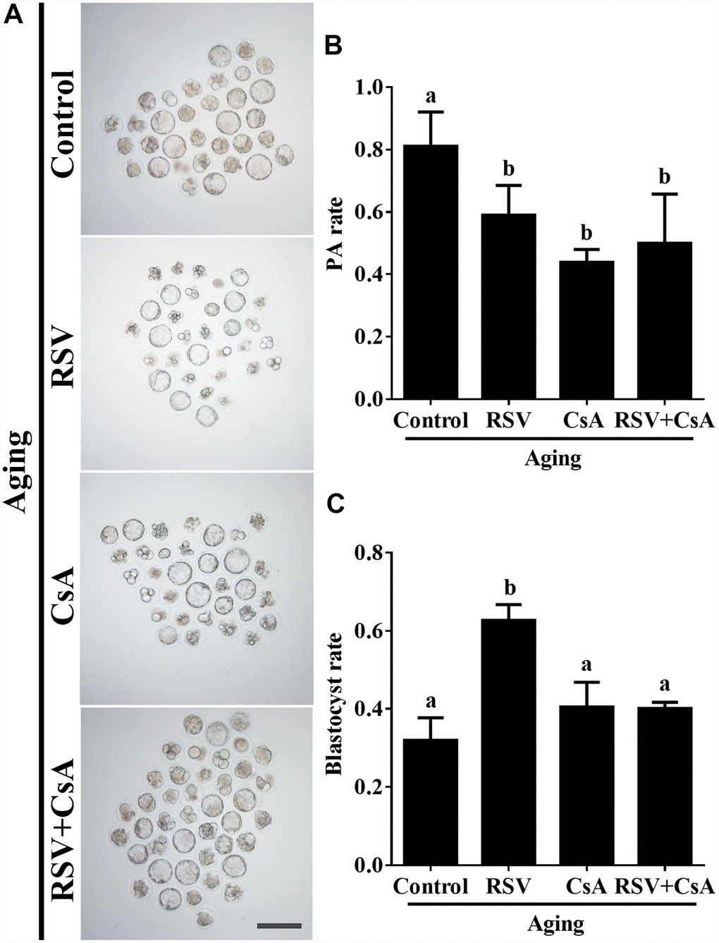The effect of RSV-induced mitophagy on developmental potential of aged oocytes. (A) After treatment with CsA, the blastocyst formation rate was detected. Bar = 200 μm. (B) Statistical results of the parthenogenetic-activation rate after RSV induced mitophagy blocked by CsA. (C) Quantitative analysis of blastocyst formation rates in (A). At least three independent experiments and more than 20 embryos were examined in each experimental group. Different lowercase letters represent the difference of expression levels that are significant (P 