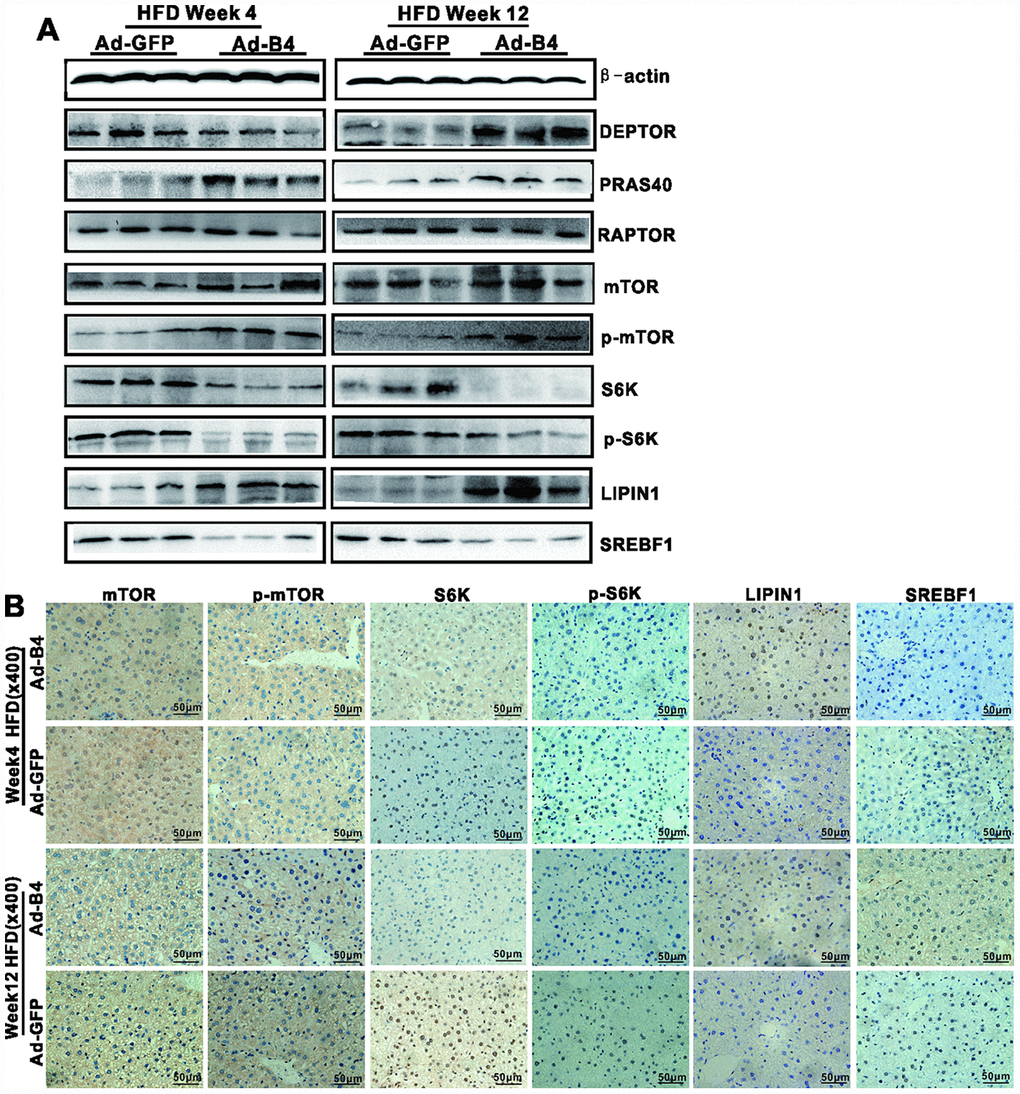 Exogenous BMP4 attenuates the development and progression of NAFLD by suppressing the mTORC1 signaling pathway. The liver samples prepared in Figure 4 were used for the following assays. (A) Total cell lysate prepared from the retrieved liver samples was subjected to Western blotting analysis to detect the expression of the members of mTORC1 signaling pathway and lipid metabolism. (B) The retrieved liver samples were paraffin-embedded, sectioned and subjected to IHC staining to detect the expression of the members of mTORC1 signaling pathway and lipid metabolism. Each assay condition was done in triplicate, and representative images are shown