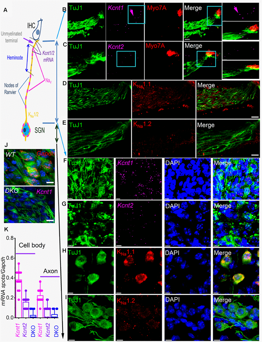 sm-FISH and immunocytochemistry localize transcripts and proteins for KNa1.1 and KNa1.2 in axons and cell bodies of spiral ganglion neurons (SGNs). Expression of KNa1-encoding transcripts in the SGNs was examined using smFISH and standard immunocytochemistry in the organ of Corti (OC)/SGN preparations from 1-mo old C57 mice (B–I). (A) Schematic illustration of the inner hair cell (IHC), type I SGN, the peripheral axon, and cell body. The unmyelinated terminal, heminode, and nodes of Ranvier are noted, but not to scale. (B) RNA molecules encoding for KNa1.1 (Kcnt1), and (C) KNa1.2 (Kcnt2), were detected as fluorescent spots (purple, arrow) in TUJ1-positive (green) SGN axons, IHCs were labeled with myosin 7A antibody (red), and merged images are shown. Axonal Kcnt1 mRNA were prominent, but only scant Kcnt2 mRNA spots were detected compared to the double knockout (DKO) samples (J). Scale bar = 10 μm (D–E) Images of cochlear sections of 1-mo old mice show that KNa1.1 (red) protein is expressed in the auditory nerve in D. Consistent with the faint expression of Kcnt2 mRNA in the axons in (E) there was virtually little or no detectable expression of KNa1.2 in axons of the auditory nerve. Scale bar = 10 μm. (F–G) mRNA spots (purple spots) encoding KNa1.1 (Kcnt1), and KNa1.2 (Kcnt2) in the cell bodies of SGNs. Very few spots for Kcnt2 mRNA were detected. Sections were co-labeled with neuronal (TuJ1, green) and nuclei markers (4,6-diamidino-2-phenylindole, DAPI, blue) Scale bar = 5 μm. (H–I) Images of the SGNs show KNa1.1 (red) protein is expressed in cell bodies of the auditory nerve. In keeping with low levels of expression of mRNA, KNa1.2 protein expression was faintly positive. The mean number of RNA molecules detected per SGN was calculated as described in the Methods. Kcnt1 levels were higher compared to Kcnt2 in both mRNA and protein levels. (J) (Upper panel). Photomicrograph showing SGN mRNA spots (red spots) encoding Gapdh (data was obtained from DKO tissue). (Lower panel) DKO cochlear section, using kcnt1 probe serving as negative controls. Similar data were obtained using the kcnt2 probe (data not shown). Scale bar = 5 μm. (K) Values of mRNA spots in axons and cell bodies were normalized against Gapdh mRNA spots/100 μm2 (11 ± 2 spots (n = 31)) are summarized in the form of bar graphs. The mean (mean ± SD) was (cell body, kcnt1 = 0.38 ±.0.11; kcnt2 = 0.16 ± 0.06; DKO = 0.02 ± 0.04; n = 11 animals; derived from 50 randomly selected cells and evaluated by 5 blinded individuals. The mean (mean ± SD) was (axons, kcnt1 = 0.22 ±.0.07; kcnt2 = 0.08 ± 0.06; DKO = 0.03 ± 0.05; n = 11 animals; derived from 50 randomly selected cells and evaluated by 5 blinded individuals.