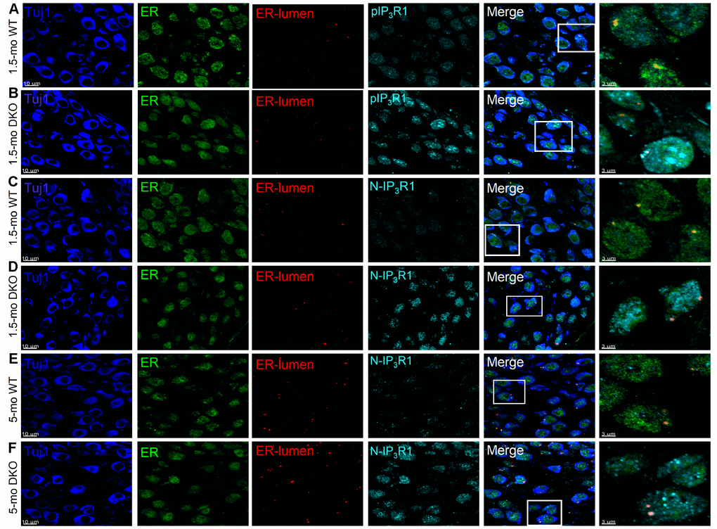 Detection of IP3R1, pIP3R1, and its proteolytic fragments in SGNs from WT and DKO cochlea. (A–F) Immunofluorescence detection of the endoplasmic reticulum (ER)-lumen domain of IP3R1(red), phosphorylation site (pIP3R1) (cyan; A–C), N-terminal domain (N-IP3R1) (cyan; C–F). We examined basal cochlear sections at 1.5-mo and 5-mo WT and DKO mice. SGNs were labeled with neuronal marker TuJ1 (blue). The ER was stained with ER-marker (blue). Merged images are shown together with digitally magnified (~3X) images, shown in the last panel. Scale bar 3 μm. For pIP3R1 at 1.5 mos, the percent of SGNs with positive reactivity for WT was 12 ± 3, and DKO was 54 ± 9; (p ± 3; DKO = 37 ± 12, and WT = 9 ± 4; DKO = 61 ± 12, respectively (p 