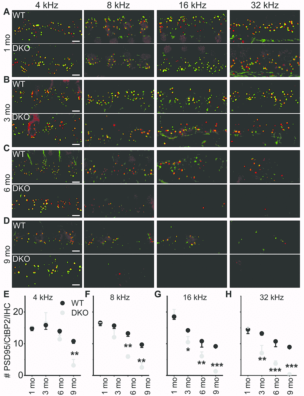 Presynaptic and postsynaptic marker counts are normal in KNa1 DKO in 1-3-, but not 6-9-mo old mice. Synapses between the spiral ganglion neurons (SGNs) and inner hair cells (IHCs) were quantified at four tonotopic locations (4, 8, 16, and 32 kHz) in the organ of Corti isolated from 1-9-mo old WT and DKO mice. (A–D) There were no obvious differences between WT and DKO mice in the organization of afferent synapses, identified as paired CtBP2 (red) and PSD95-(green) immunopuncta. Images presented as Z-projections were made using stacks of confocal micrographs from the 4, 8, 16, and 32 kHz region as indicated. (E–H) Quantification of the average number of synapses per IHC showed no statistically significant differences between WT (black) and DKO (grey) animals at 1 month of age. However, with increasing age from 3- to 9-mo, statistical differences among the synapse counts appeared and gradually encompassed more tonotopic regions. Statistical differences were observed first at the high-frequency segment of the cochlea. Values (mean ± SEM) are illustrated (p 