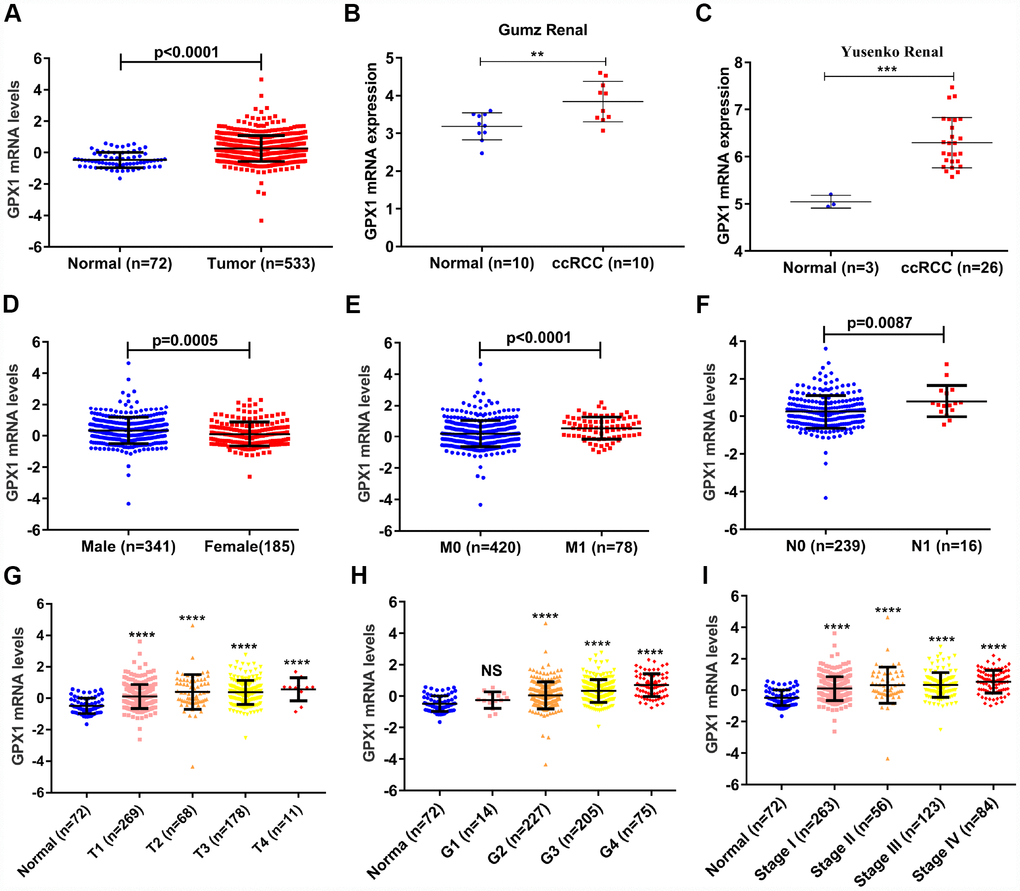 GPX1 is overexpressed and positively associated with higher tumor stage in ccRCC samples. (A) The mRNA expression levels of GPX1 were up-regulated in ccRCC samples, which were downloaded from TCGA-KIRC database containing 72 normal samples and 533 ccRCC samples. (B–C) The mRNA expression levels of GPX1 were up-regulated in ccRCC in statistics by Gumz et al. and Yusenko et al, which were downloaded from ONCOMINE database. The expression levels of GPX1 mRNA were compared in various clinical pathological parameters: (D) Gender, (E) M stage, (F) N stage, (G) T stage, (H) G stage, (I) TNM stage. (T means Territory; M means distant metastasis; N means Lymph node metastasis. ****, P 