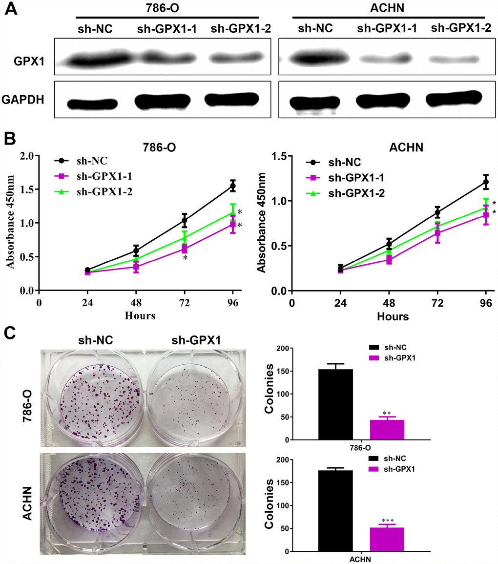 The knockdown of GPX1 levels inhibits the proliferation capability of renal cancer cells in vitro. (A) As shown by immunoblotting results, the expression levels of GPX1 were knocked down by transfecting sh-GPX1 plasmids. (B) CCK8 results showed that GPX1 knockdown significantly inhibited the proliferation of renal cancer cells. (C) GPX1 knockdown obviously reduced the colony formation ability of renal cancer cells. (***, P 