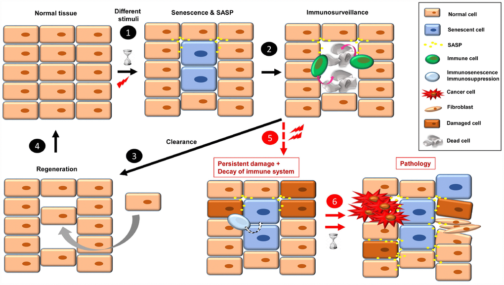 The onset of cellular senescence in normal tissue takes place in response to different stimuli (1). Some SASP factors are involved in immune cell recruitment, which act in the clearance of the senescent cells (2). Then, to restore the normal tissue, a regeneration process is necessary (3, 4). When a combination of persistent damage and immune system decay occurs, senescent cells accumulate, creating a pro-inflammatory and pro-tumorigenic environment and fibrotic tissue. Over time, this leads to disease, such as cancer progression, insulin resistance, osteoarthritis, atherosclerosis, and brain pathologies, among others (5, 6).