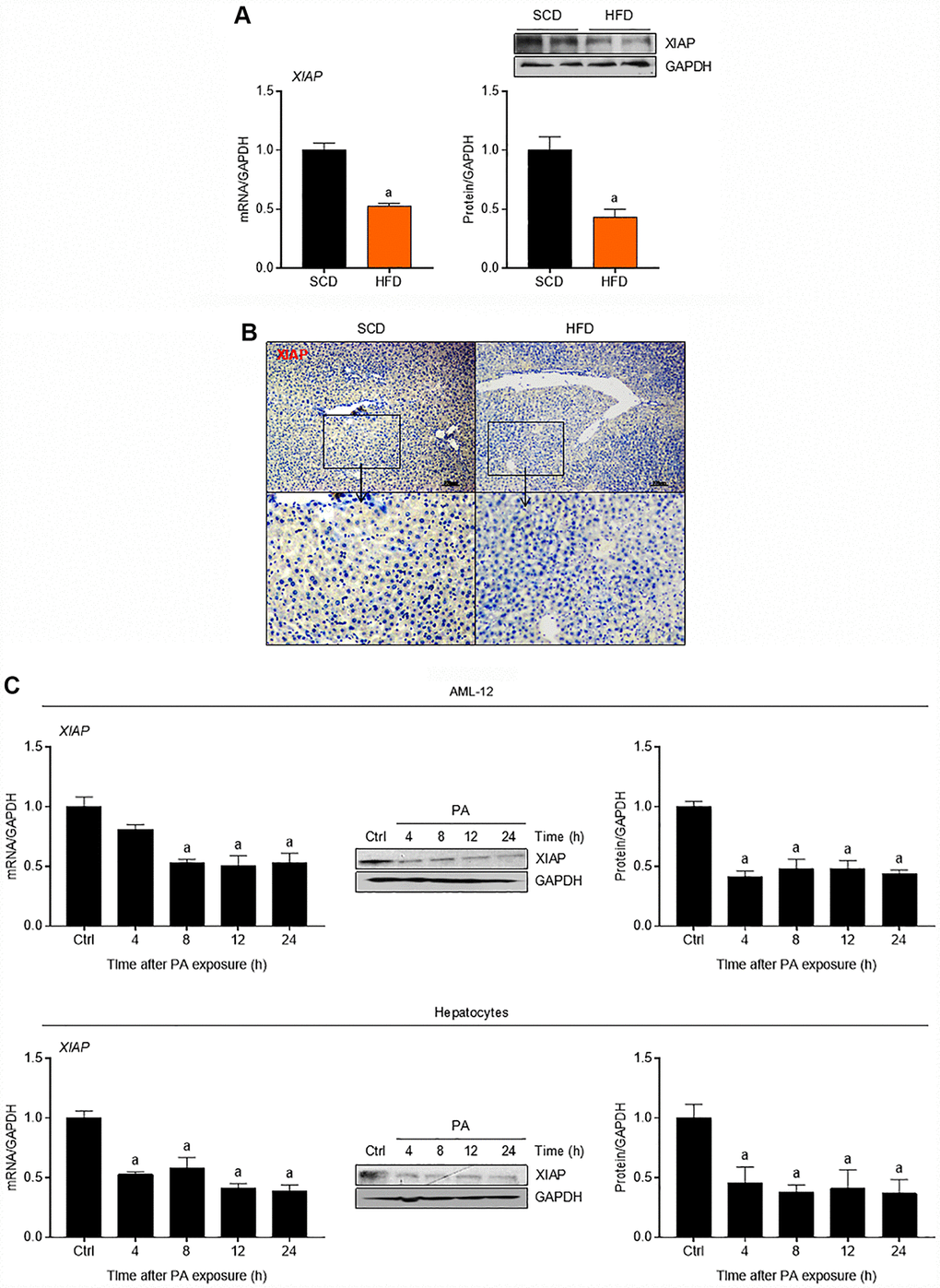 XIAP is down-regulated in fatty liver of mice fed with HFD. (A) qPCR, immunoblotting and (B) immunohistochemical analysis of XIAP expression in liver tissues from scrambled RNA mice fed a SCD or HFD for 12 weeks. (C) Primary mice hepatocytes and normal AML-12 cells were treated with 250 μM palmitate (PA) for 0, 4, 8, 12 or 24 hours, followed by determination of XIAP expression in mRNA and protein levels using qPCR or western blotting detection. For all bar plots shown, data are expressed as the mean ± SEM. n = 8 per group. ap 