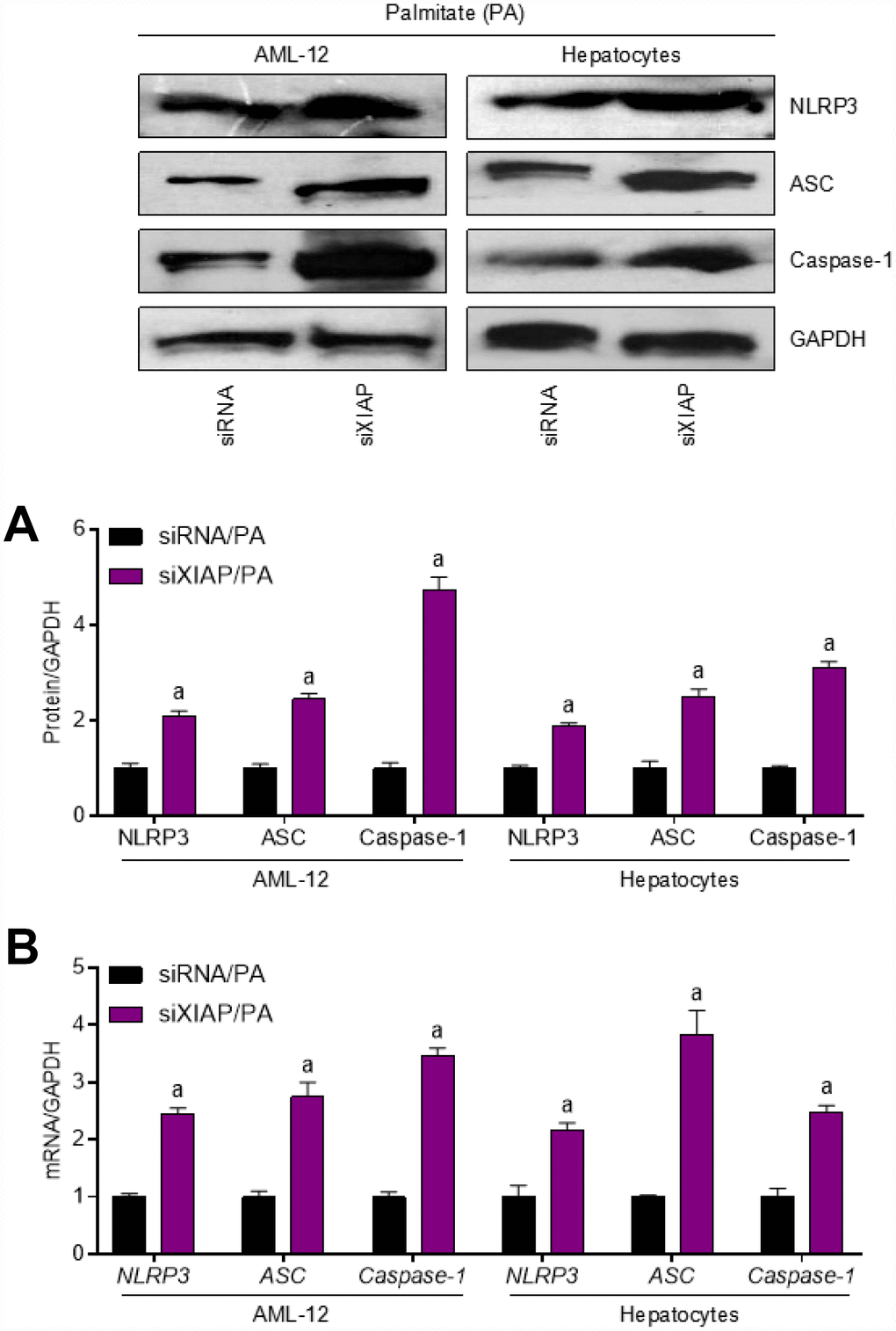 Inhibition of XIAP positively regulates PA-triggered inflammation in vitro. AML-12 and primary hepatocytes were transfected with XIAP siRNA for 24 h, followed by PA (250 μM) treatment for another 24 h. Then, further studies as exhibited were performed. (A and B) Representative western blot and qPCR detection showed the changes in mRNA and protein levels of NLRP3 inflammasome (NLRP3, ASC and Caspase-1) in PA-induced cells. For all bar plots shown, data are expressed as the mean ± SEM. n = 8 per group. ap 