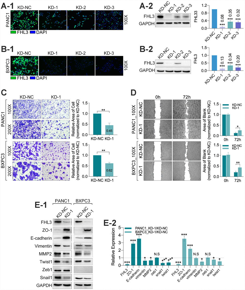 FHL3 knockdown restrained migration and reversed EMT phenotype in pancreatic cancer cells. (A1 and B1) IF assay of FHL3 in PANC1