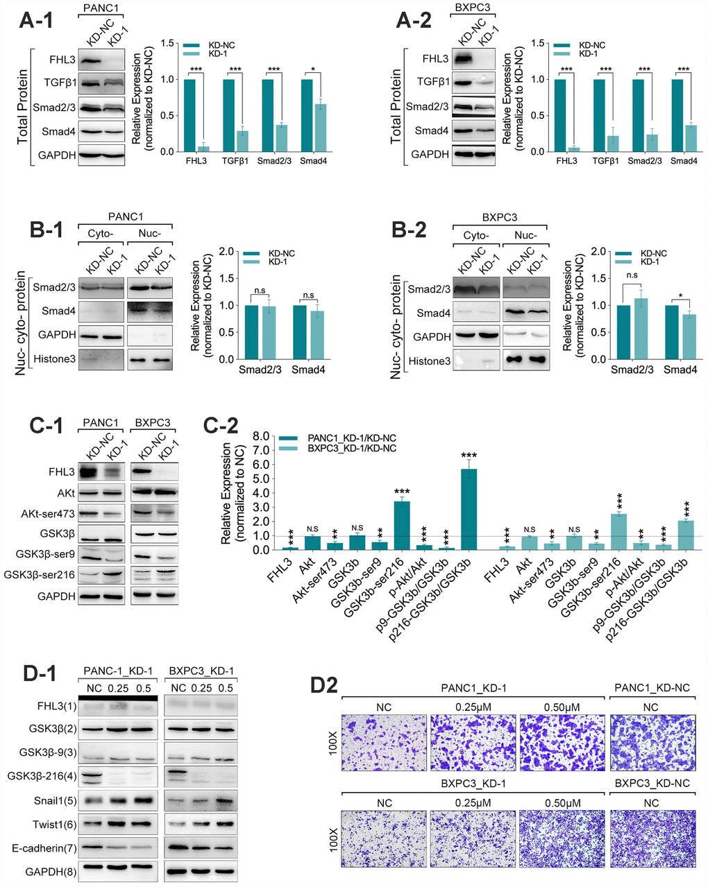 FHL3 regulated EMT mainly by TGFβ1/Akt/GSK3β/ubiquitin pathway. (A1 and A2) WB assay showed FHL3 knockdown made downregulation of TGFβ1, smad2/3, and smad4 in PANC1