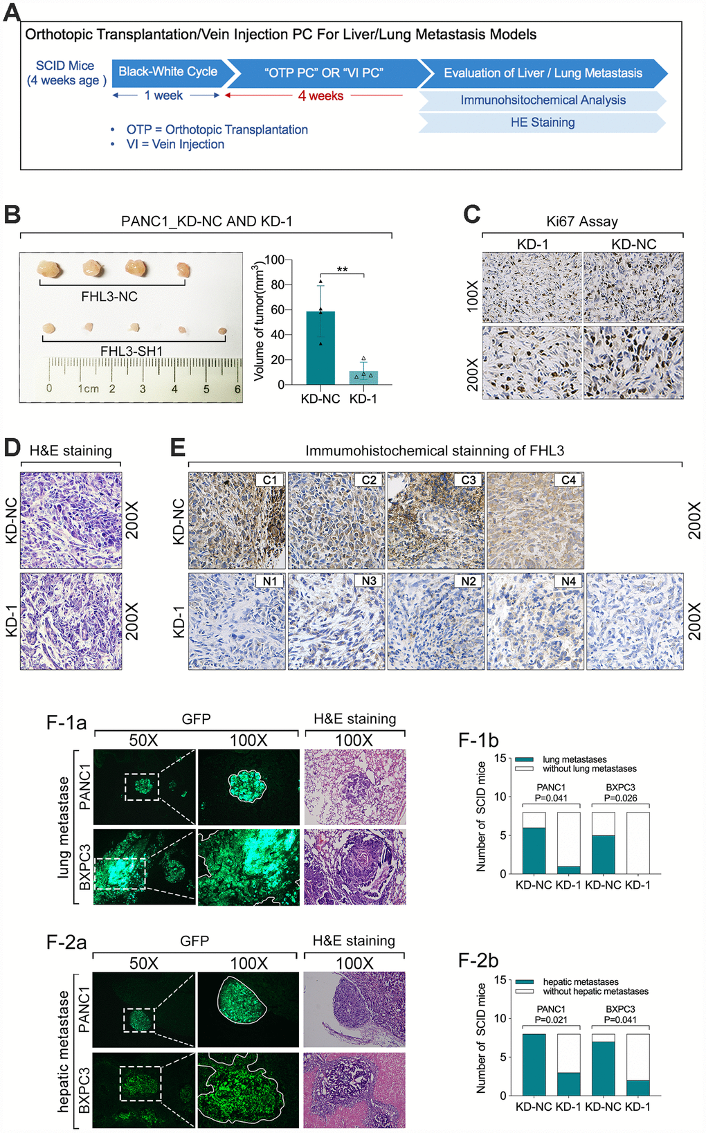 FHL3 knockdown inhibited pancreatic tumor growth and metastasis in vivo. (A) experiments process in vivo. (B) tumor volume of PANC1