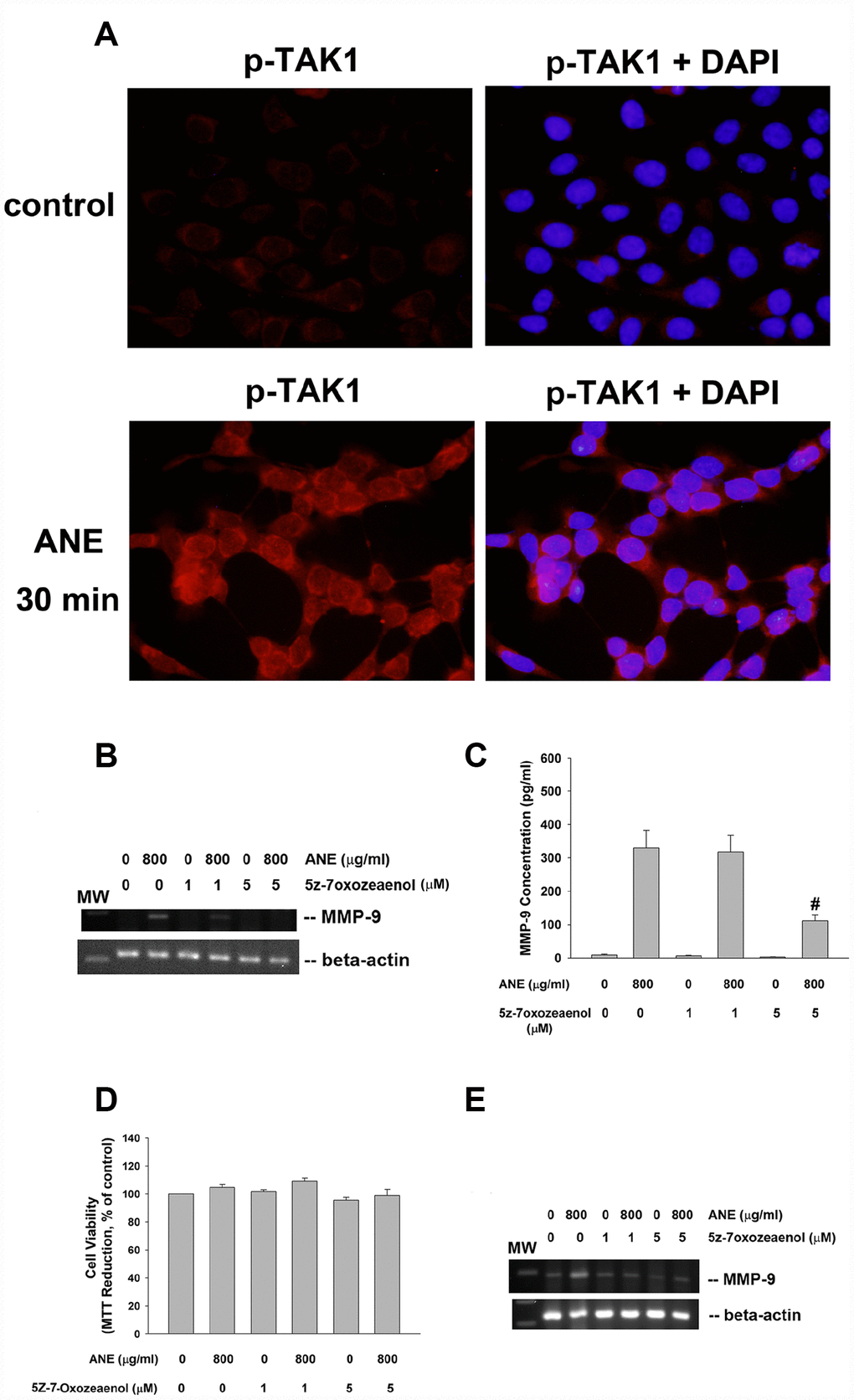 Role of TAK1 activation in ANE-induced MMP-9 expression/secretion. (A) Stimulation of p-TAK1 activation of SAS cells by ANE. (upper) solvent control, and (lower) SAS cells treated by ANE (800 μg/ml) for 30 min. Pictures of p-TAK1 fluorescence (left) & merged with DAPI (right). Effects of 5Z-7-Oxozeaenol (1 and 5 μM) on (B) ANE (800 μg/ml)-induced MMP-9 mRNA expression of SAS cells as analyzed by semi-quantitative RT-PCR. One representative result was shown, and (C) ANE (800 μg/ml)-induced MMP-9 secretion in SAS cells as analyzed by ELISA. (D) Effect of ANE with/without 5Z-7-Oxozeaenol on the viability of SAS cells (as % of control, 100%), (E) ANE-induced MMP-9 mRNA expression of GK as analyzed by semi-quantitative RT-PCR.