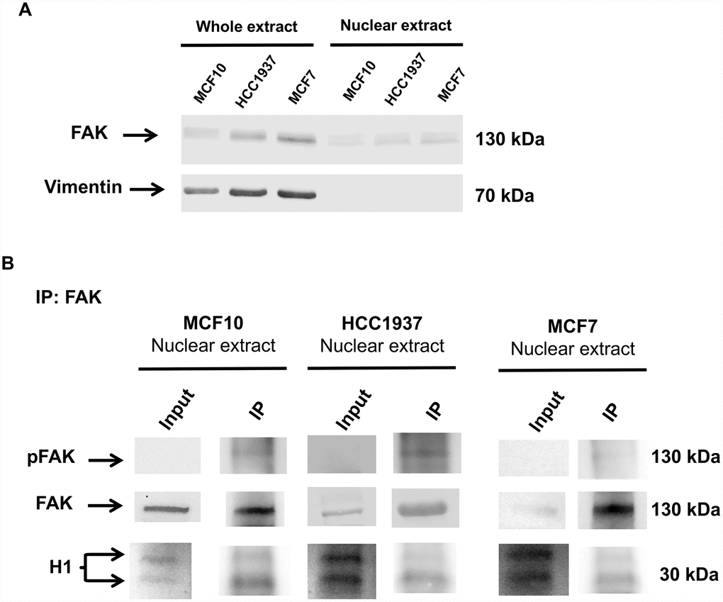 Immunoprecipitation analysis of nuclear FAK and histone H1. Immunoprecipitation (IP) analysis demonstrated that nuclear FAK associates with H1 histone. IP was carried out with anti-FAK antibody (3285, Cell signaling), followed by immunoblotting with anti-FAK (D2R2E, Cell signaling), anti-pFAK (Y576/577) and anti-H1 antibodies. IP experiments were done on MCF7, HCC1937 and MCF10 cell lines. The images are representative of three independent biological replicates. Panel A shows the levels of FAK in whole and nuclear extracts; Vimentin blot assess that nuclear extracts are not contaminated by cytoplasmic fraction.