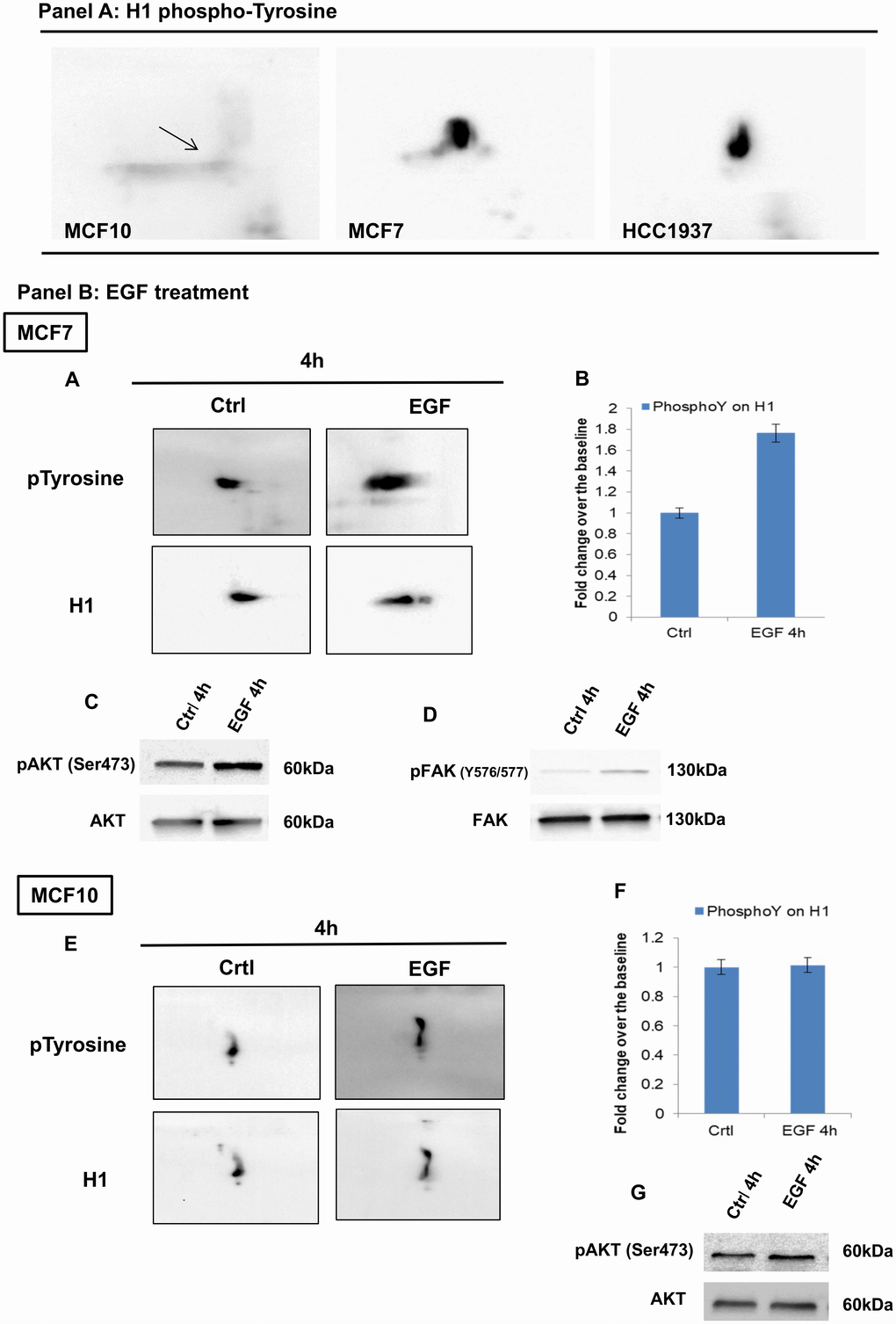 Analysis of H1 histone tyrosine phosphorylation in breast and normal cancer cells, using 2D-TAU western blot. (Panel A) 2D western blots showing tyrosine phosphorylation on the Histone H1 in MCF10, MCF7 and HCC1937 cells. Arrow indicates the region corresponding to the phosphorylated protein. Blot images were acquired using Alliance 2.7 (UVITEC, Eppendorf, Milan, Italy). Membranes signals were acquired concomitantly at 4 seconds. (Panel B) (A) 2D TAU western blot analysis of histone H1 tyrosine phosphorylation on MCF7 cells (acquisition time: 4’’) and (E) MCF10 cells (acquisition time: 20’’) following EGF stimulation. Lower panels indicate the relative normalization with H1 antibody; the relative densitometry analyses are shown in B for MCF7 cells and in F for MCF10 cell lines. The assays were repeated in three independent biological replicates Data are expressed as mean ± SEM (N =3). (C, G): Western blot analysis of pAKT and AKT levels on whole protein extracts from EGF treated MCF7 and MCF10 cells, respectively. (D) Western blot analysis of pFAK (Y576/577) levels on whole protein extracts from EGF treated MCF7.