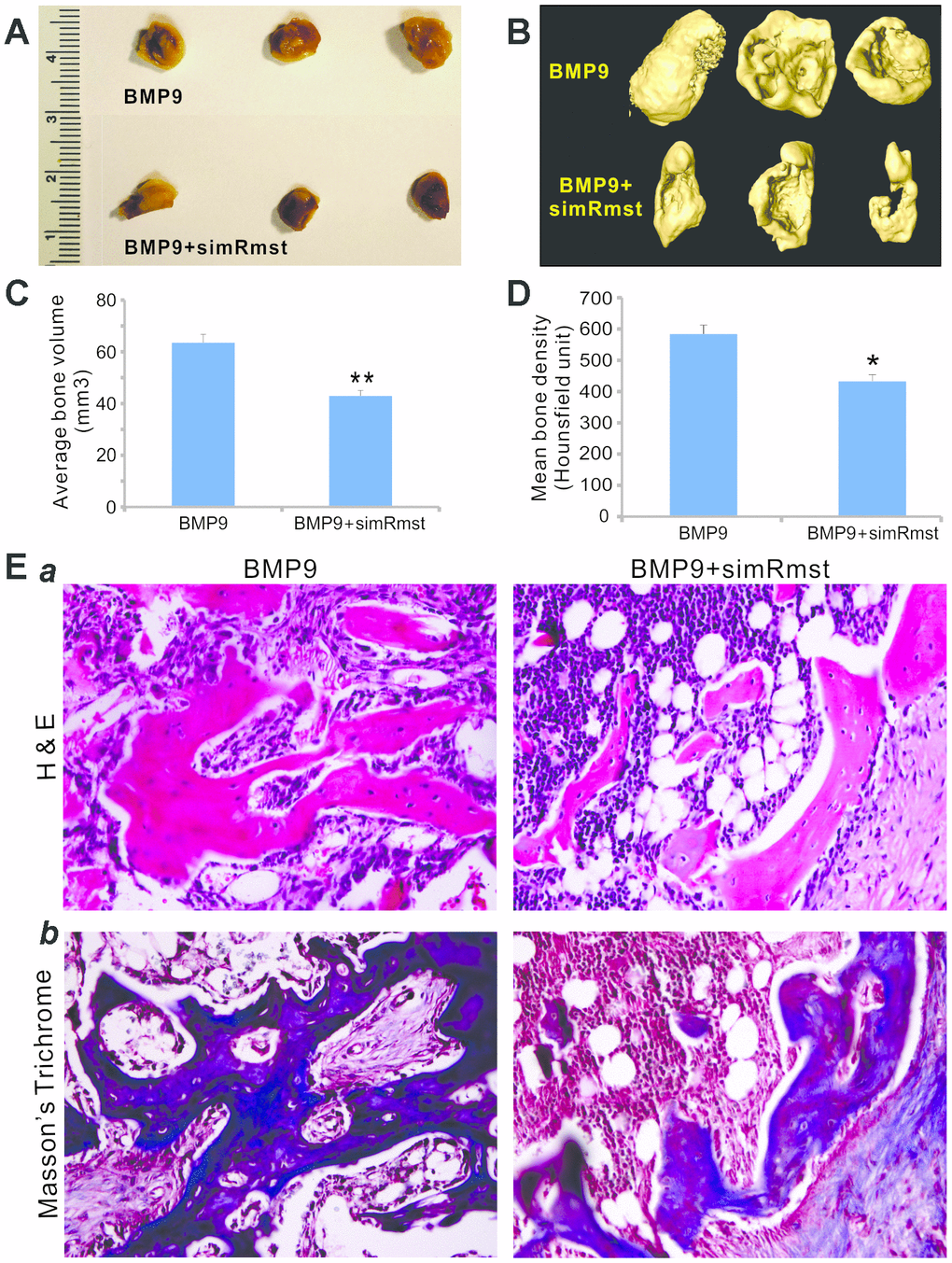 Silencing Rmst expression attenuates BMP9-induced ectopic bone formation. Subconfluent iMADs were infected with Ad-BMP9, Ad-GFP, and/or AdR-simRmst for 30h and collected for subcutaneous injection into the flanks of athymic nude mice. At 4 weeks after implantation, the mice were sacrificed and ectopic bone masses were retrieved. Representative macrographic images (A) and micro-CT isosurface images (B) are shown. No retrievable masses were found in the Ad-GFP or AdR-simRsmt alone group. The average bone volume (C) and mean bone density (D) were determined by analyzing micro-CT data using the Amira program. “*” pvs. Ad-BMP9+AdR-simRmst group. (E) Histologic evaluation and trichrome staining. The retrieved masses were processed and subjected to hematoxylin and eosin staining (a) and Masson’s trichrome staining (b). Representative images are shown.