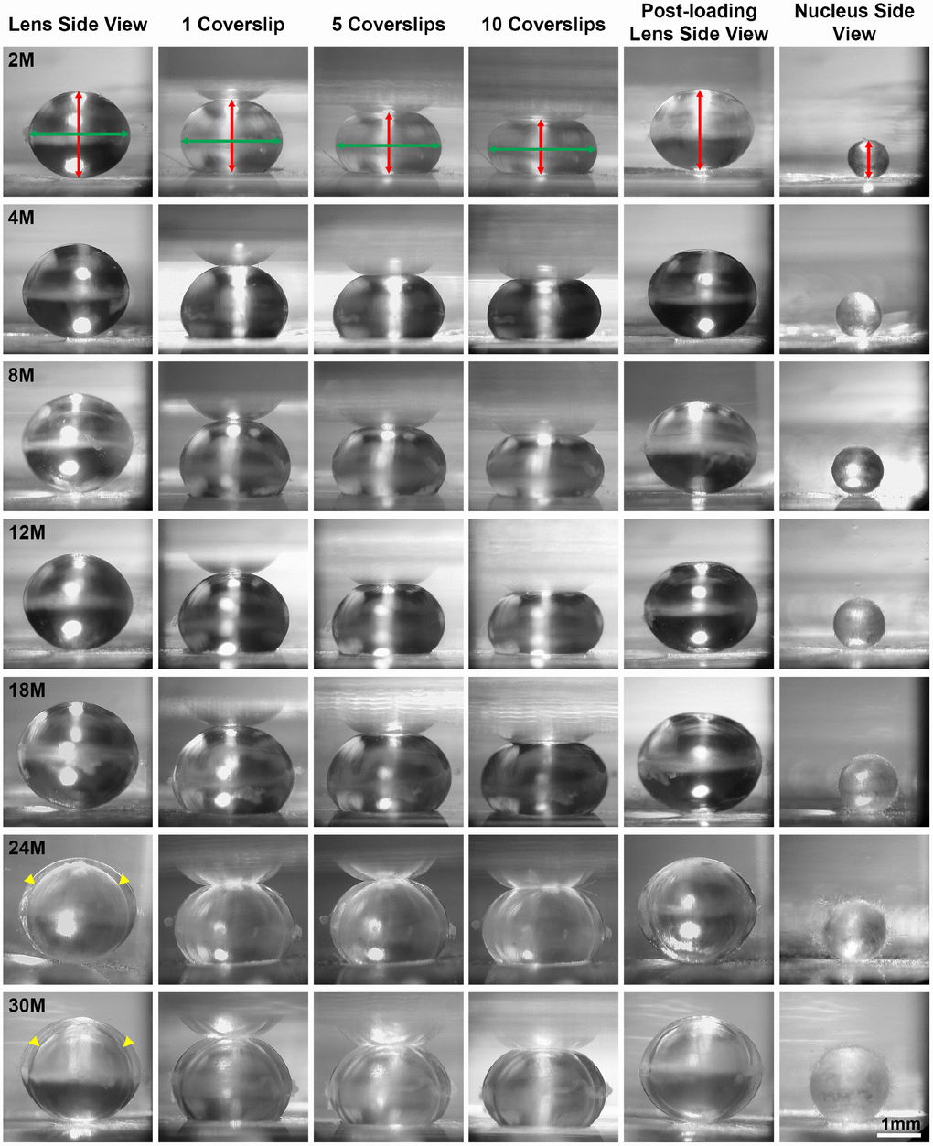 Side view pictures of mouse lenses between 2-30 months of age pre-compression, during coverslip compression (1, 5 and 10 coverslips) and post-compression, and the isolated lens nucleus. With age, the application of the same load compressed the older lenses less than young lenses. There is an overall increase in lens size and nucleus size with age. The axial diameter (red double-headed arrows) and the equatorial diameter (green double-headed arrows) for each lens were measured to calculate lens volume, lens aspect ratio, axial compressive strain, equatorial expansion strain, resilience and nuclear volume. In very old lenses (24-30 months), there is an area of optical discontinuity in the lens cortex (yellow arrowheads). Scale bar, 1mm.