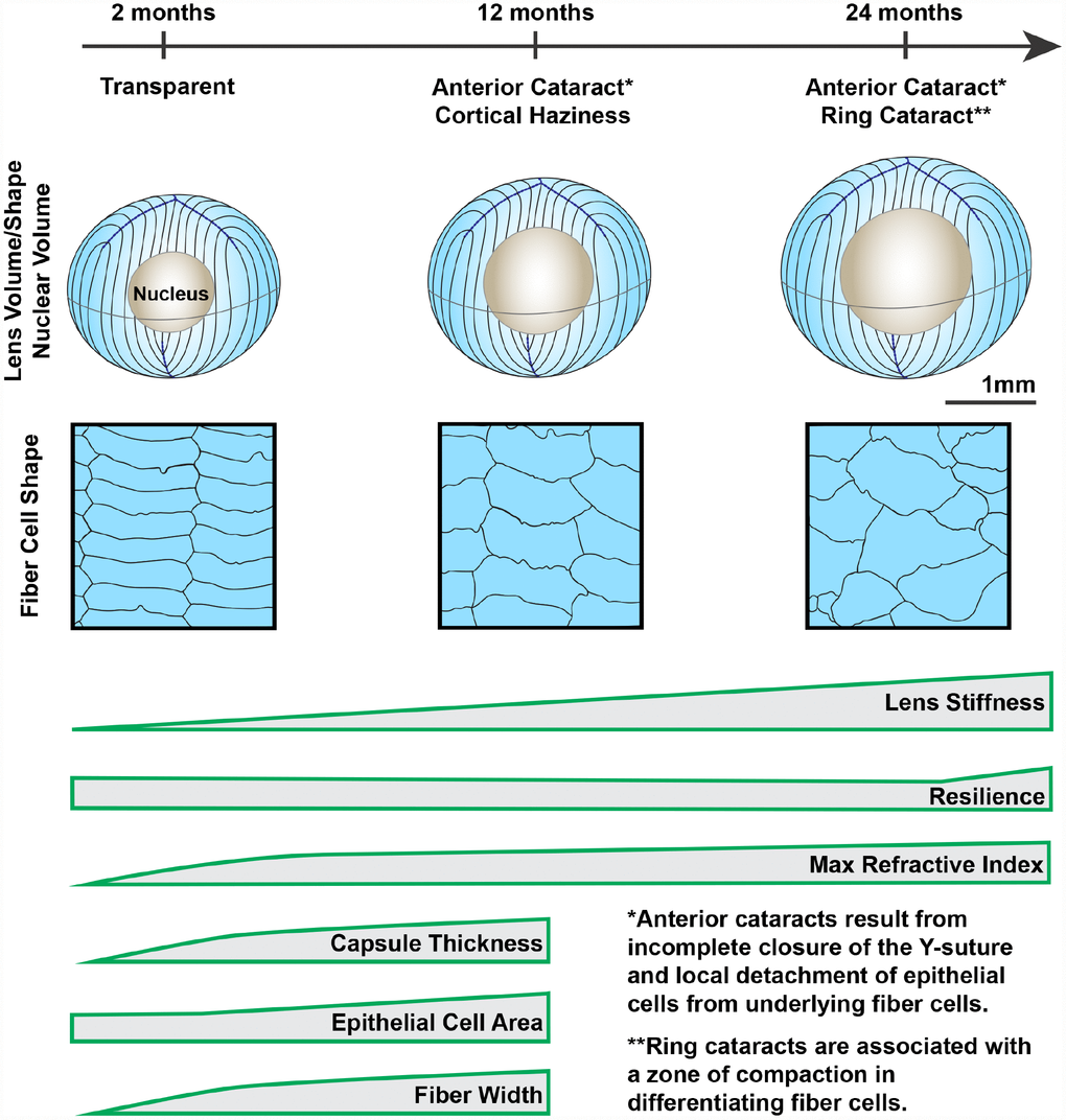 Wild-type mouse lenses in the B6 genetic background showed increased volume, nucleus size and overall stiffness, changes in cell morphology and microstructure along with appearance of anterior, cortical and ring cataracts with age. Lens volume and nucleus volume increase steadily with age. The shape and size of lens fiber cells become more disorganized in aged lenses. With age, mouse lenses develop anterior and cortical cataracts. Anterior cataracts are correlated with detachment of the anterior epithelial cells from the underlying fiber cells. Cortical ring opacities in the aged lenses are due to a zone of compaction in the cortical fiber cells leading to an optical discontinuity. While there is a steady increase in lens stiffness with age, resilience, or lens elasticity, is only increased in very old lenses. The maximum refractive index at the center of the lens (nucleus) increases rapidly until 6 months of age and reaches a plateau at 6 months. Lens capsule thickness and fiber cell width remain steady after 4 months of age, while epithelial cell area increases slightly between 4 and 12 months of age. Cartoons not all drawn to scale.