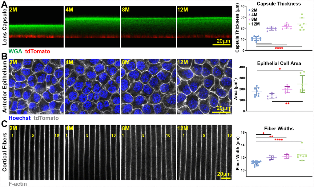 Live lens measurements of capsule thickness and anterior epithelial cell area and fixed lens measurements of cortical fiber cell width. Lines on the plots reflect mean ± SD of n = at least 6 lenses per age. Data from 2-month-old samples are reprinted from our previous publication [53]. *, pppA) Lens capsule thickness increases between 2 months and older ages, but the thickness is unchanged after 4 months of age. WGA (lens capsule) is shown in green, and tdTomato signal (basal surface of anterior epithelial cells) is shown in red. (B) Anterior epithelial cell area is increased between 2 and 4 months and 12 months of age. Cell nuclei (Hoechst) is shown in blue, and tdTomato signal (lateral membrane of anterior epithelial cells) is shown in grayscale. (C) Cortical fiber cell width increases between 2-month-old and older lenses, but there is no increase in fiber cell width after 4 months of age. The fiber cells are numbered showing 11 full-width cells in the 2-month-old lens and 10 full-width cells in lenses that were 4 months and older. These measurements show that although mouse lenses continue to increase in size with age, capsule thickness and fiber cell size only increase until about 4 months of age. There is a mild increase in epithelial cell size up to 12 months of age.