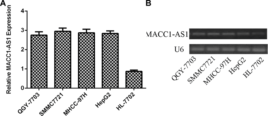 MACC1-AS1 was overexpressed in HCC cells. (A) The expression of MACC1-AS1 in four HCC cell lines (QGY-7703, SMMC7721, MHCC-97H and HepG2) and one hepatocyte cell line (HL-7702) was detected by qRT-PCR. (B) The expression of MACC1-AS1 in four HCC cell lines (QGY-7703, SMMC7721, MHCC-97H and HepG2) and one hepatocyte cell line (HL-7702) was detected by PCR.