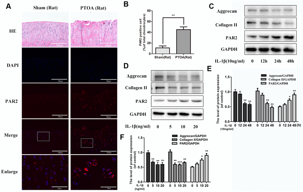 PAR2 is highly expressed in rat OA cartilage tissue and in IL-1β treated chondrocytes. (A) Representative H&E staining and immunofluorescence staining of PAR2 in rat knee articular cartilage from sham and PTOA model. (B) Quantitation of immunofluorescence staining of PAR2. (C, D) Representative western blots and quantification data of PAR2, Collagen II and Aggrecan in chondrocytes after stimulation with various dose of IL-1β for 24h. (E, F) Representative western blots and quantification data of PAR2, Collagen II and Aggrecan in chondrocytes after stimulation with 10ng/ml IL-1β under different time course. Data are shown as the mean ± SD. Significant differences between groups are indicated as ***P 