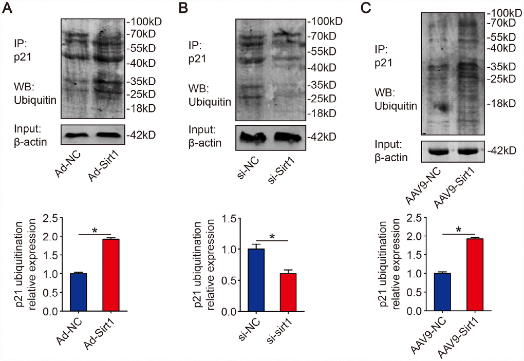 Sirt1 promotes p21 ubiquitination. (A) Isolated P1 CMs were transfected with Ad-NC or Ad-Sirt1. Whole cell lysates were immunoprecipitated with a p21 antibody and analyzed by Western blotting using an ubiquitin antibody (n=3). (B) Isolated P1 CMs were transfected with si-NC or si-Sirt1. Whole cell lysates were immunoprecipitated with a p21 antibody and analyzed by Western blotting using an ubiquitin antibody (n=3). (C) 8-week-old mouse hearts were injected with AAV9-NC or AAV9-Sirt1. Heart lysates were immunoprecipitated with a p21 antibody and analyzed by Western blotting using an ubiquitin antibody (n=5). Statistical significance was calculated using two-tailed unpaired Student’s t-test in (A–C). *p