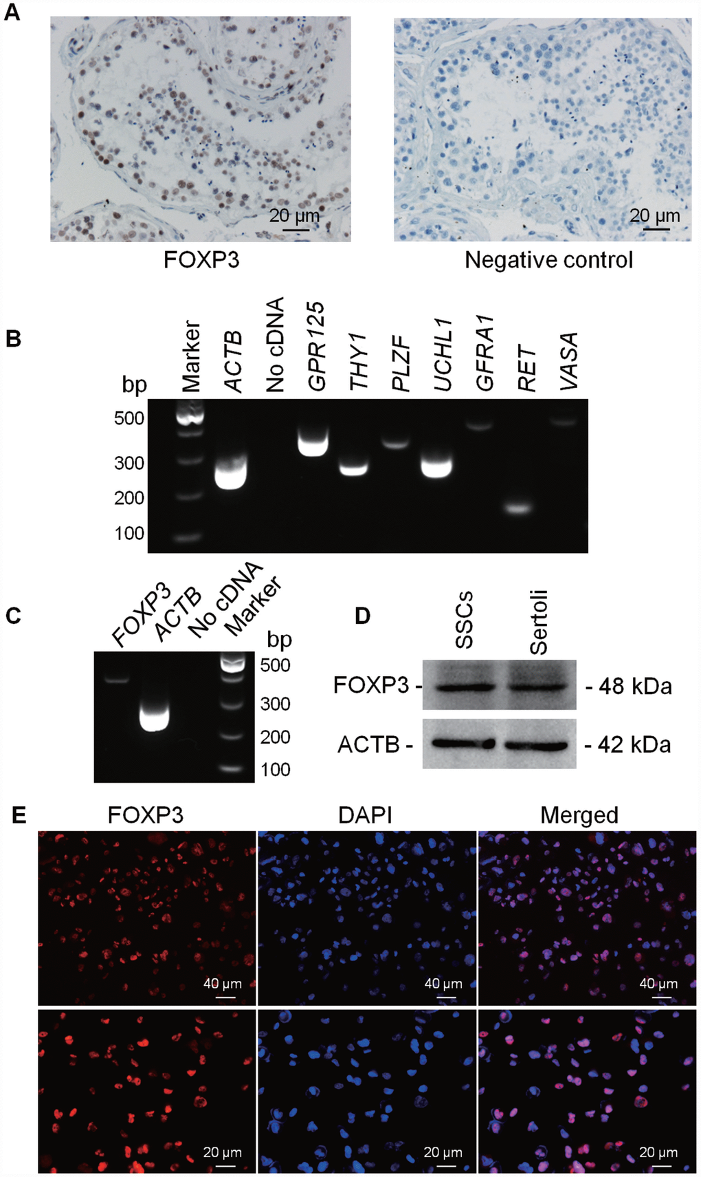 Expression and location of FOXP3 proteins in human testes and human SSC line. Immuno-histochemistry revealed cellular localization of FOXP3 in human testes (left panel). Replacement of anti-FOXP3 with PBS was used as a negative control (right panel). Scale bars = 20 μm. (B) RT-PCR showed the transcripts of GPR125, THY1, PLZF, UCHL1, GFRA1, RET and VASA in human SSC line. Samples without cDNA (No cDNA) but PCR with gene primers were used as negative controls. ACTB served as loading controls of total RNA. (C) RT-PCR showed the mRNA level of FOXP3 in human SSC line. Samples without cDNA (No cDNA) but PCR with gene primers were used as negative controls, and ACTB served as a loading control of total RNA. (D) Western blots revealed the expression of FOXP3 protein in human SSC line. ACTB served as the control of the loading proteins. Human Sertoli cells were utilized as a positive control. (E) Immunocytochemistry revealed cellular localization of FOXP3 in human SSC line. Fluorescent signals of FOXP3 (red) and DAPI (blue) were imaged individually and merged under fluorescence microscope. Scale bars = 40 μm and 20 μm, respectively. All experiments were repeated for at least three times.