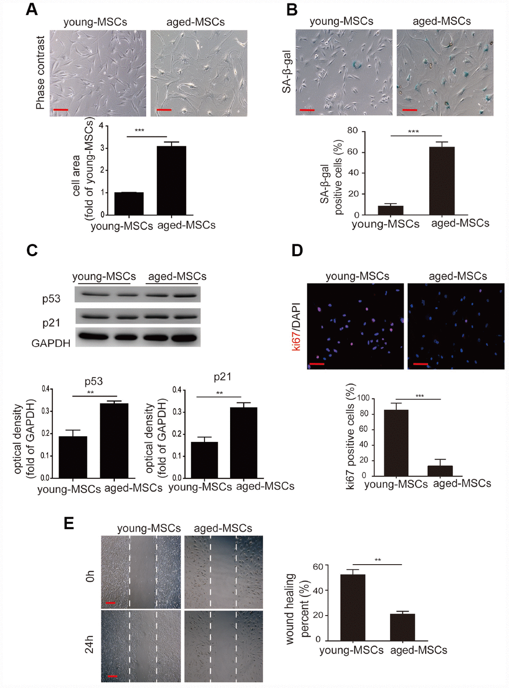 Aged MSCs display increased cellular senescence. (A) Representative images of young and aged MSCs under light microscopy, and quantitative analysis of the cell size of young and aged MSCs. (B) Representative images of SA-β-gal staining, and quantitative analysis of SA-β-gal-positive cells among young and aged MSCs. (C) Western blotting and quantitative analysis of p53 and p21 protein expression in young and aged MSCs. (D) Representative images of Ki-67 staining and quantitative analysis of Ki-67-positive cells among young and aged MSCs. (E) Representative images of the wound healing assay and quantitative analysis of the wound recovery rate in young and aged MSCs. Scale bar=100 μm. Data are expressed as the mean±SEM. n=3. **p