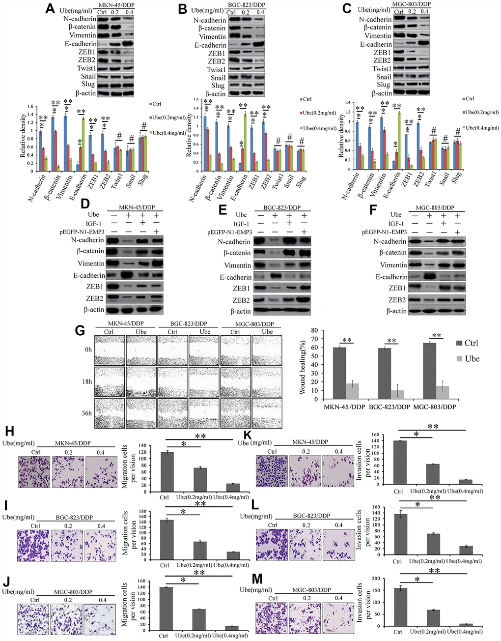 Ubenimex suppresses the EMT, migration, and invasion of CDDP- resistant GC cells by attenuating the activation of the CD13/EMP3/PI3K/AKT/NF-κB pathway. (A–C) Western blot assay was employed to explore the expression of EMT markers in MKN-45/DDP (A), BGC-823/DDP (B) and MGC-803/DDP cells (C), which were stimulated with Ubenimex (0.2 or 0.4 mg/mL) for 24 h. Data are expressed as the representatives (upper panels), and relative expression with means ±SD (bottom panels). **P0.05. (D–F) Indicated cells were pre-treated with pEGFP-N1-EMP3 plasmid for 24 h or IGF-1 (10ng/mL)or 8h, followed by treatment with Ubenimex (0.4mg/mL) for another 24 h, indicated EMT markers in MKN-45/DDP cells (D), BGC-823/DDP (E) and MGC-803/DDP (F) cells were detected by Western blot assay. (G) Wound healing assays were carried out to determine the migration abilities of CDDP-resistant GC cells which were treated with Ubenimex. Cell morphology of gap with different widths at 0, 18, and 36 h were obtained (left panels), and data are summarized as the means ± SD of “healing ratio”(right panel) **PH–M) Transwell assays was performed to identify the changes of the migration (H–J) and invasive (K–M) abilities in CDDP-resistant GC cells which were treated with Ubenimex (0.2 or 0.4 mg/mL) for 24h. Results were shown as the representatives (left panels) and the number of migrated and invasive cells with the means±SD (right panels) from three experiments. *P