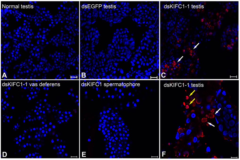 Effects of kifc1 knockdown on P. japonicus testis detected using the TUNEL assay. (A) No apoptosis signal was detected in the normal testes. (B) No apoptosis signal was detected in dsEGFP testes. (C) Apoptosis signal was detected in dsKIFC1-1 testes. (D) No apoptosis signal was detected in dsKIFC1-1 vas deferens. (E) No apoptosis signal was detected in dsKIFC1-1 spermatophore. (F) In dsKIFC1-1 testes, apoptosis was taken place in spermatogonia (white arrows) and spermatocytes (yellow arrows). Blue: DAPI, Red: TUNEL. Scale bar = 20μm in A, B and C. Scale bar = 10μm in D, E and F.