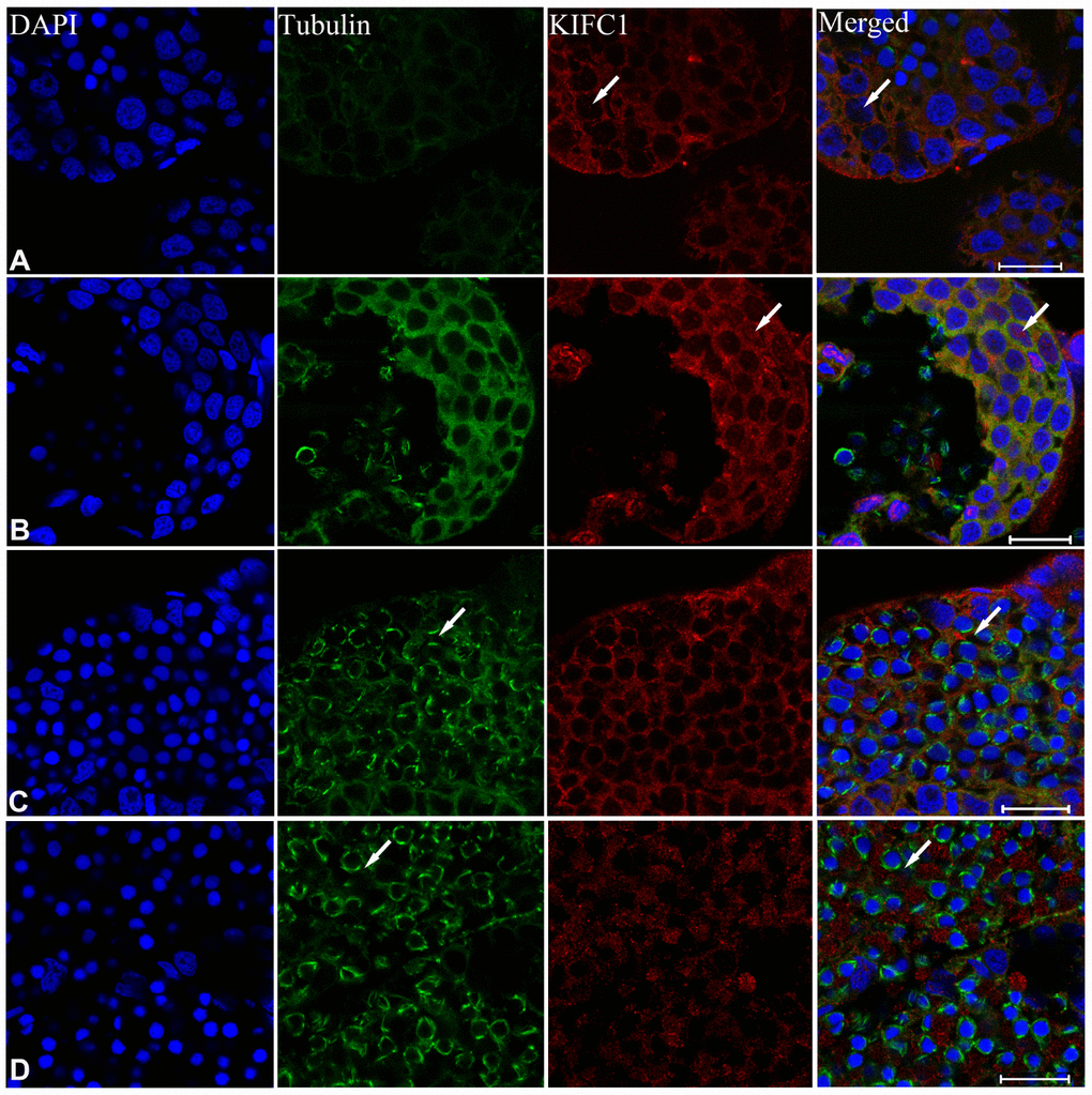 Immunofluorescent localization of KIFC1 and tubulin during spermatogenesis in the testis of P. japonicus. (A) Spermatogonia. KIFC1 and microtubules were co-localized in the cytoplasm. KIFC1 signal also can be detected in nucleus (white arrows). (B) Spermatocyte. The distribution of KIFC1 and microtubules in spermatocyte was same with that in spermatogonia. The difference was that both KIFC1 and microtubules signal in this stage were increased obviously (white arrows). (C) Early spermatid. KIFC1 and microtubules were distributed in the perinuclear cytoplasm. At this time, the microtubules started to assemble at one end (white arrows). (D) Late spermatid. A mass of KIFC1 spread over the spermatid cytoplasm. The microtubules exhibited spindle morphology around the sperm nucleus (white arrows). Blue: DAPI, Green: tubulin, Red: KIFC1. Scale bar= 20μm.