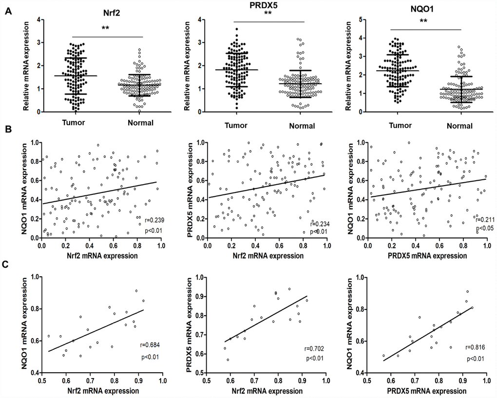 The correlation of Nrf2, PRDX5 and NQO1 mRNA expression in NSCLC specimens. (A) Nrf2, PRDX5 and NQO1 mRNA expressions in both tumor tissues and the adjacent normal tissues (**P B) Statistical correlations among Nrf2, PRDX5 and NQO1 expressions in NSCLC samples. (C) Statistical correlations among Nrf2, PRDX5 and NQO1 expressions in NSCLC patients with Clinical TNM stage III-IV.