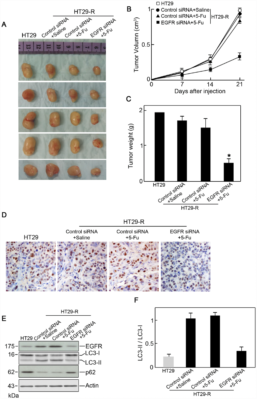 EGFR contributes to 5-FU resistance in colon cancer cells through autophagy. (A) Xenograft tumors formed in nude mice. A total of 5 × 106 cells was subcutaneously injected into nude mice (n=5 for each group). The mice were sacrificed on day 21 after the injection. Tumors were harvested and representative images are shown. (B) and (C) EGFR knockdown promoted the anticancer effect of 5-FU in vivo as demonstrated by reduced tumor volume (B) and tumor weight (C) (n=5). (D) Immunohistochemical staining of Ki-67 in xenograft specimens. (E) Autophagy induction in a xenograft model was decreased by EGFR silencing upon 5-FU treatment. (n=5) (F) Conversion of LC3-I to LC3-II was inhibited by EGFR silencing upon 5-FU treatment (n=5, *P 