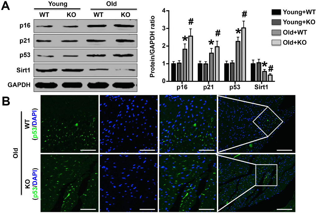 Effects of IL-12p35 KO on the expression of aging marker-related proteins. (A) The left ventricular p16, p21, p53 and Sirt1 expression levels in each group were investigated by Western blotting analysis; n=10-11 for each group. (B) Cardiac p53 expression was detected by immunofluorescence staining (200x); n=5 for each group. * p# p