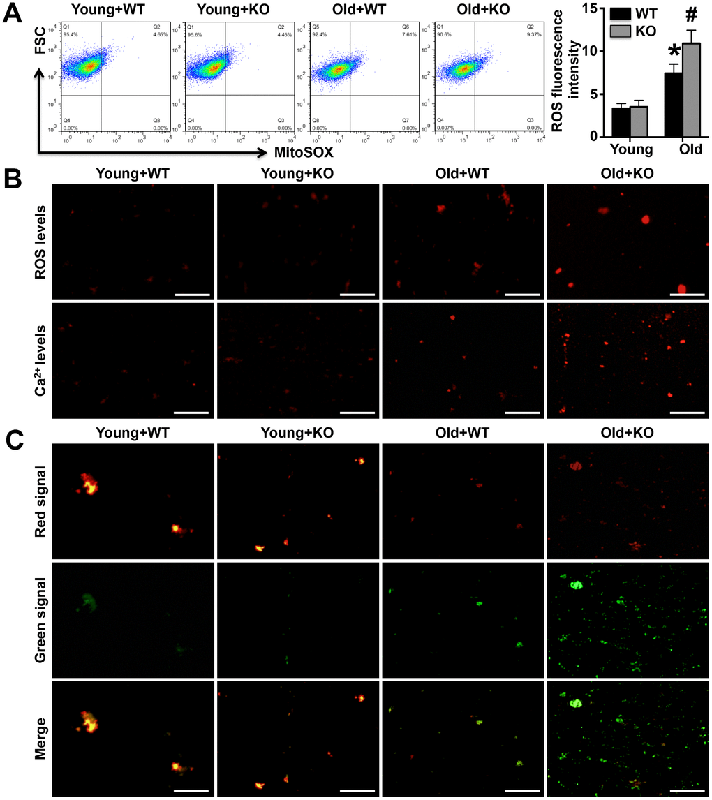 Mitochondrial fluorescence intensity of calcium and ROS and membrane potentials were detected. (A). The mitochondrial ROS fluorescence intensity was investigated by the Flow Cytometry analyses. (B). The MitoSOX Red Mitochondrial Superoxide Indicator probe and the Rhod-2 AM probe were used to mark mitochondrial calcium ions and ROS, respectively (400x). (C). The mitochondrial membrane potential was detected using the JC-1 probe (400x). N=5-6 for each group.