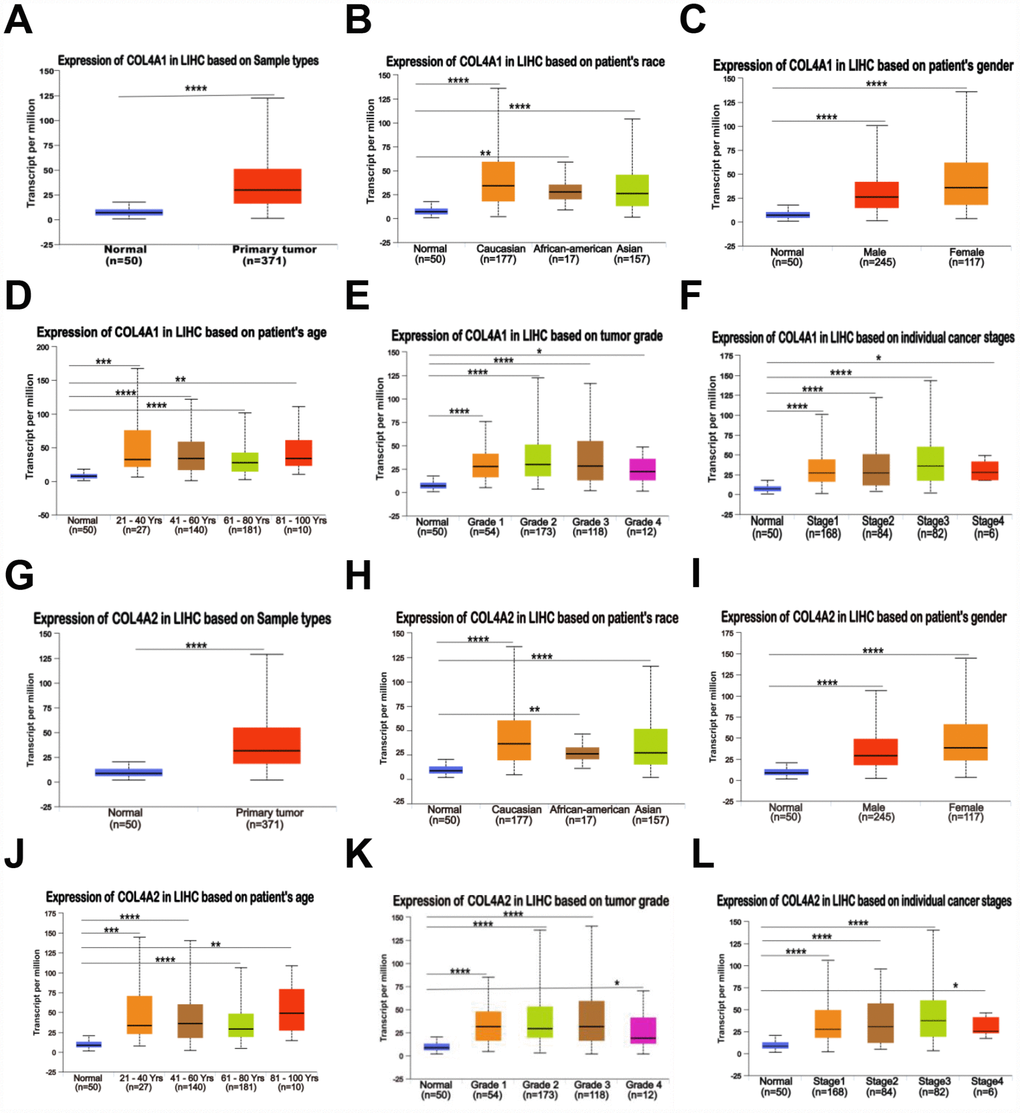 Relationship between the mRNA levels of COL4A1/2 and the clinic pathological features of patients with HCC, stratified based on ethnicity, gender, age, tumor grade, and disease stages (UALCAN). (A, G) Box plot showing the relative transcript level of COL4A1 and COL4A2 in normal and primary tumor (HCC) tissues. (B, H) Box plot showing the relative transcript level of COL4A1 and COL4A2 in normal samples of any ethnicity, and HCC tissues of Caucasian, African-American or Asian. (C, I) Box plot showing the relative transcript level of COL4A1 and COL4A2 in normal tissues of any gender, and HCC tissues of male or female. (D, J) Box plot showing the relative transcript level of COL4A1 and COL4A2 in healthy individuals of any age, and HCC tissues of 21–40, 41–60, 61–80, or 81–100 yrs. (E, K) Box plot showing the relative transcript level of COL4A1 and COL4A2 in normal tissues, and HCC tissues with grade 1, 2, 3 or 4. (F, L) Box plot showing the relative transcript level of COL4A1 and COL4A2 in normal tissues, and HCC tissues in stage 1, 2, 3 or 4. Data are mean ± SE. *, P 