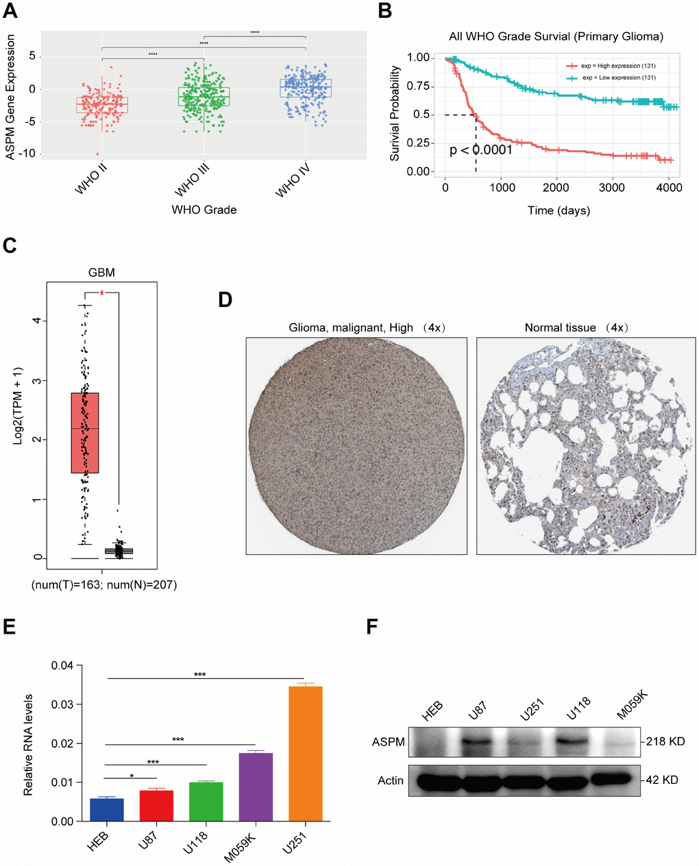 ASPM is highly expressed in human GBM tissues and cell lines. (A) Expression profiles of ASPM in GBM form grade II to grade IV. Red points indicate the expression level of ASPM in grade II glioma; green points indicate the expression level of ASPM in grade III glioma, and blue points indicates the expression level of ASPM in grade IV glioma. (B) Patients with high expression of ASPM in glioma had a significantly poor prognosis (n=262, p C) Box plot of ASPM expression in GBM from GEPIA. The box plot is based on 163 GBM cancer samples and 207 normal samples. The expression level of RNA was upregulated in GBM tissues compared with normal tissues. *p D) The Human Protein Atlas project shows representative immunohistochemical images of ASPM in GBM compared with normal tissues. (E) and (F) The RNA and protein levels of ASPM were detected in four GBM and one normal glial cell line by RT-qPCR and western blot. *p 