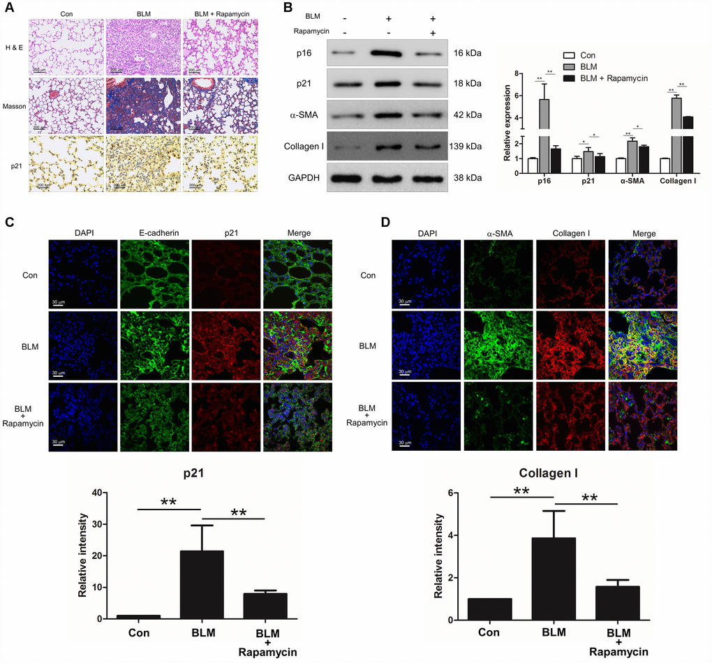 Rapamycin could protect mice from bleomycin (BLM)-induced pulmonary fibrosis. Mice (n = 10 in each group) were intraperitoneally injected with vehicle (DMSO/PBS, 10%) or 5 mg/kg rapamycin every other day starting 7 days after administration of BLM (5 mg/kg). (A) Pulmonary fibrosis was determined by haematoxylin and eosin (H&E) staining. Collagen was revealed by Masson’s trichrome staining. The expression of p21 was measured by immunohistochemical analysis. (B) The protein levels of p16, p21, α-SMA and collagen I were detected by Western blot. The expression levels were quantified with ImageJ (n = 3). GAPDH was used as a loading control, *P C, D) The lung tissues were double stained with E-cadherin and p21 (C), α-SMA and collagen I (D) by immunofluorescence. The positive areas of p21 and collagen I were quantified by densitometry (n = 3), **P 